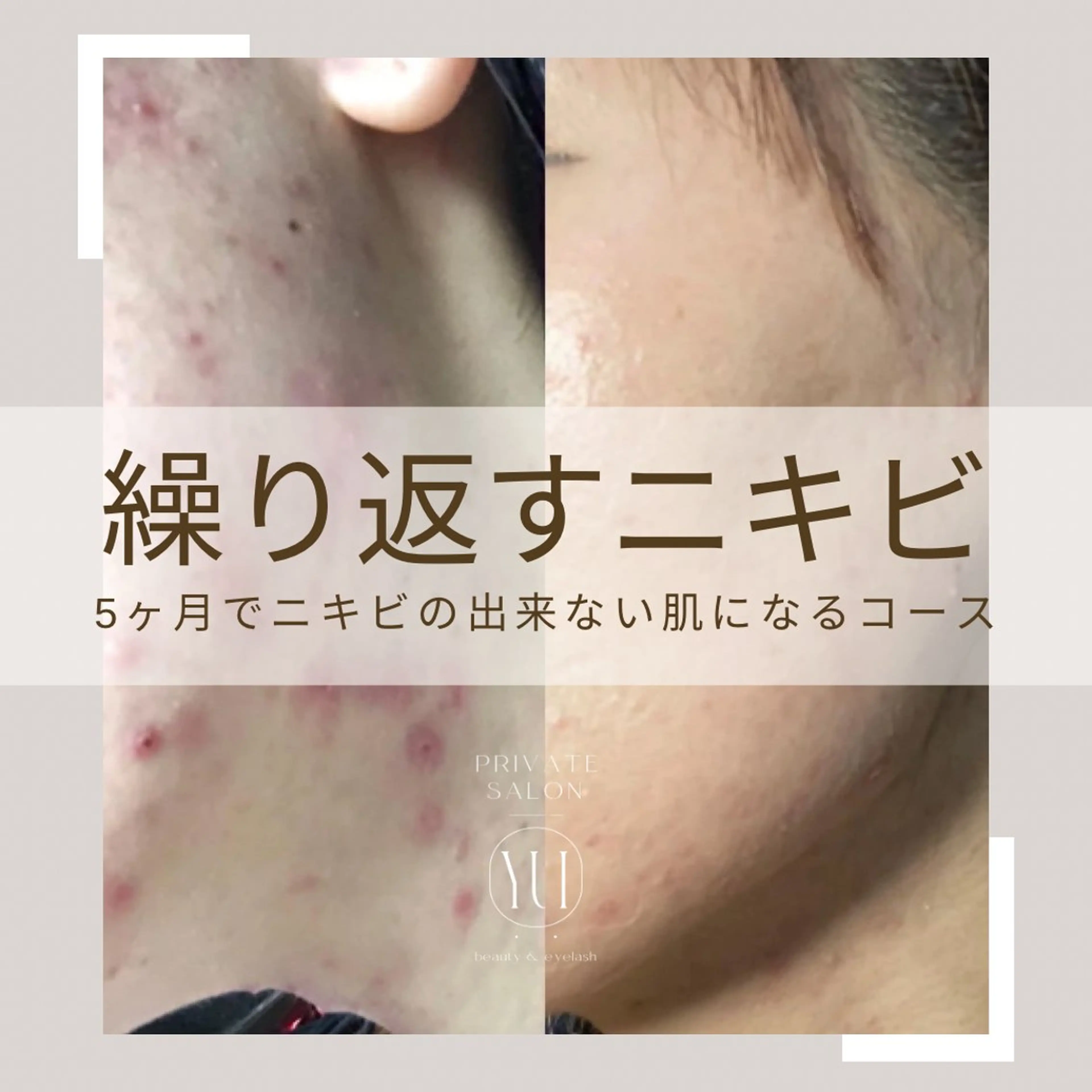 1ヶ月後も半分残る 高持続LEDエクステのマツエク・マツパデザイン