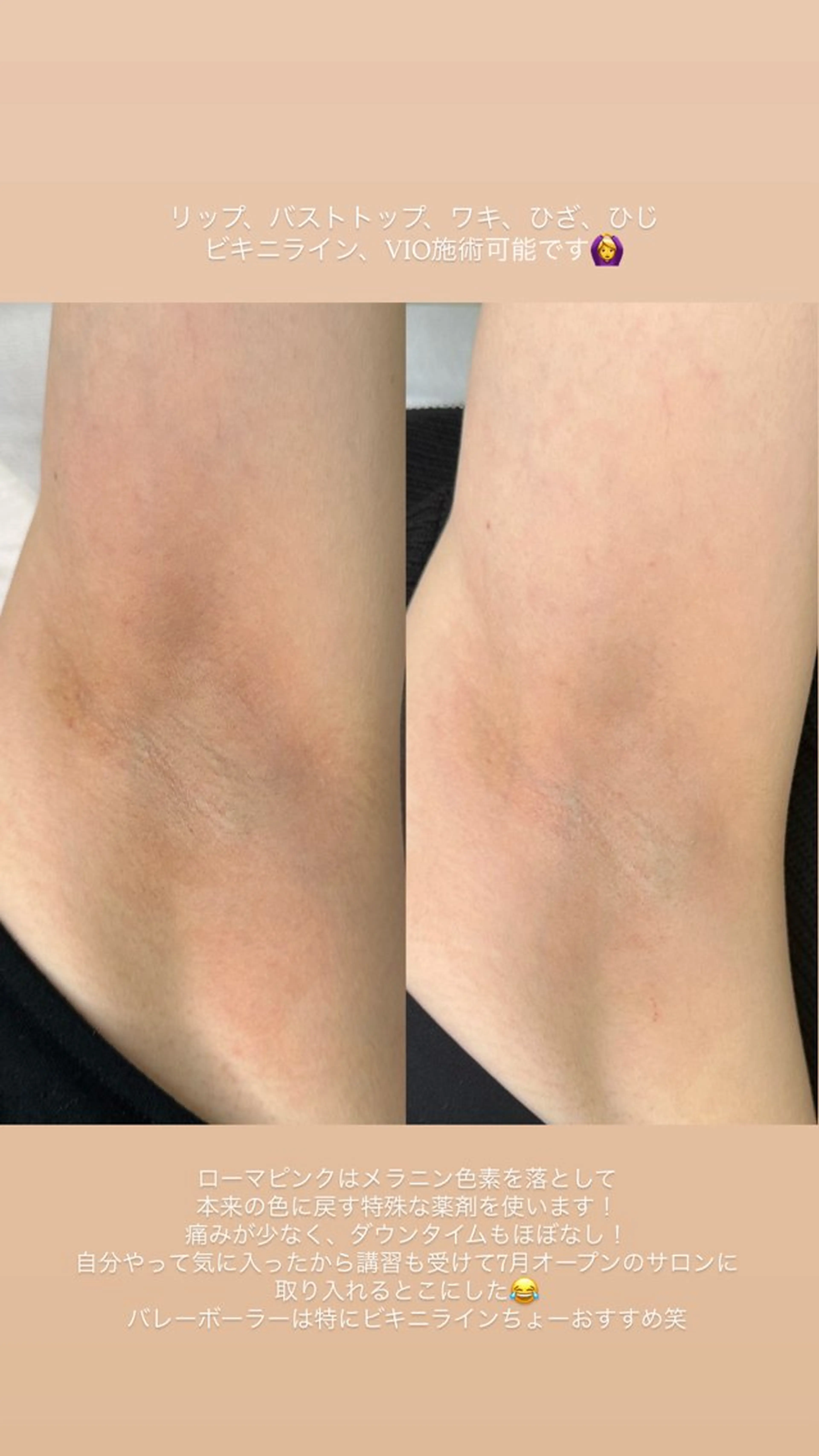 Rosée所属・Rosée南青山 ビューティーサロンのエステ・リラクイメージ