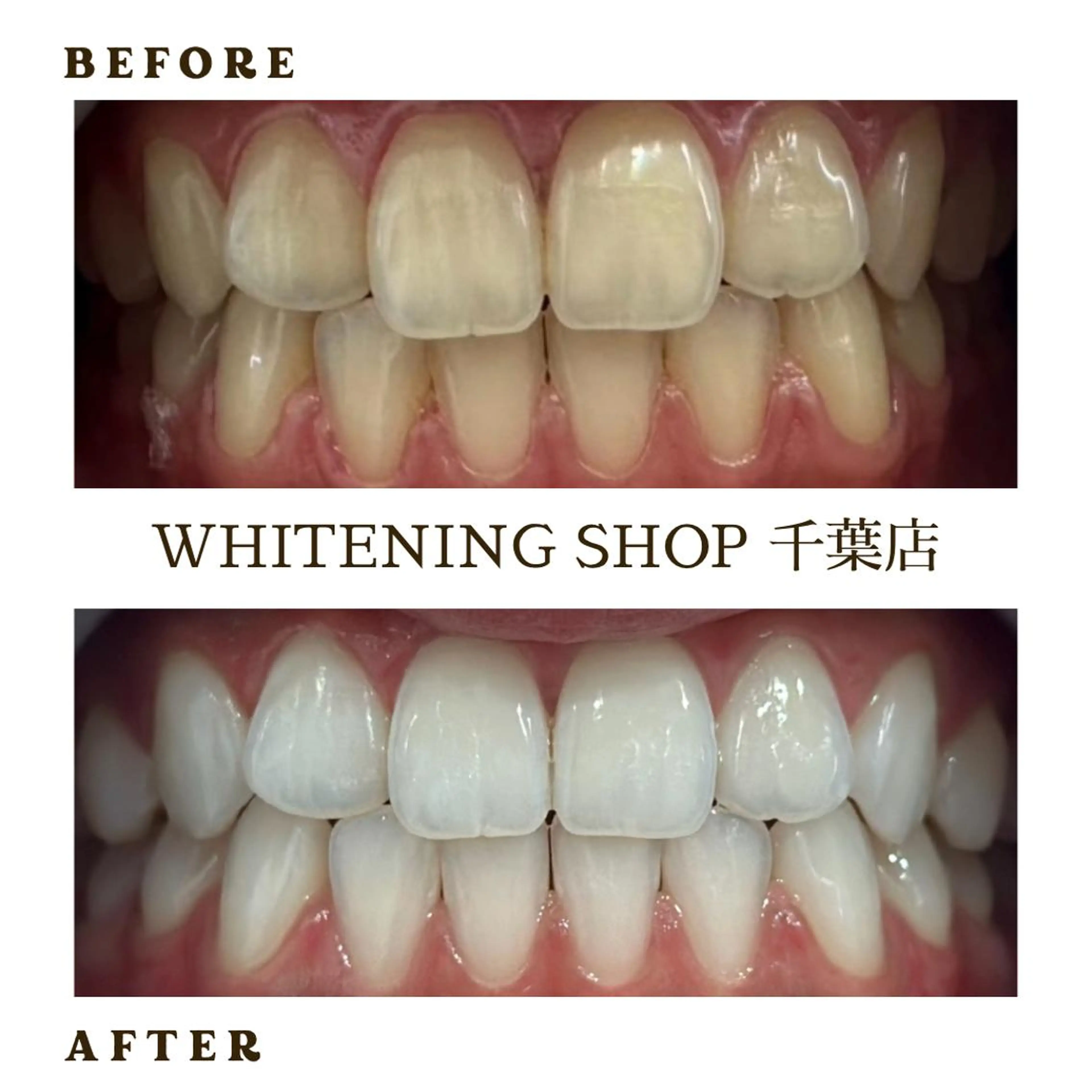 メンズ エステ ホワイトニング ショップ千葉店のその他イメージ