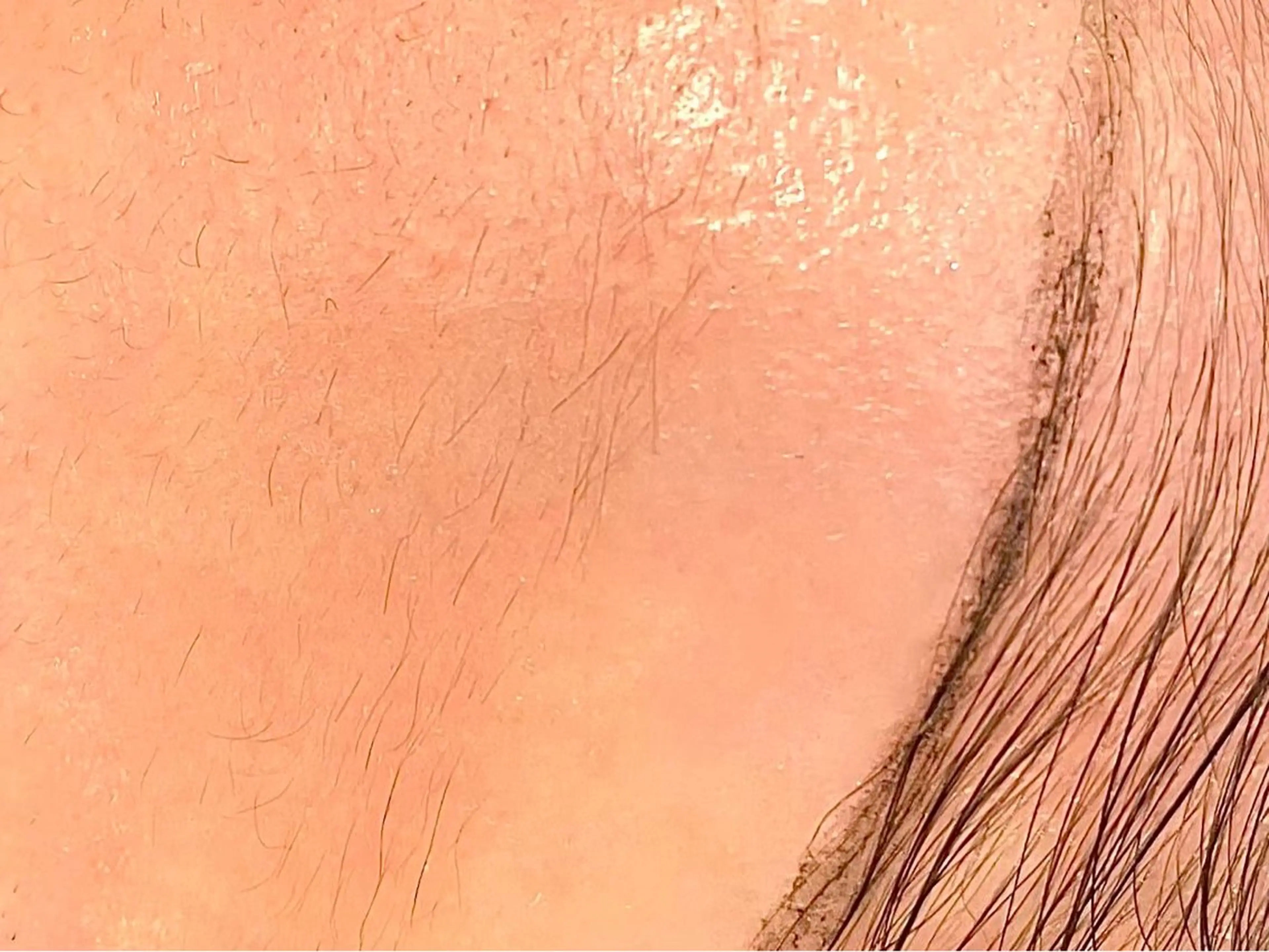 エステ 毛穴洗浄 ワックス脱毛のエステ・リラクイメージ