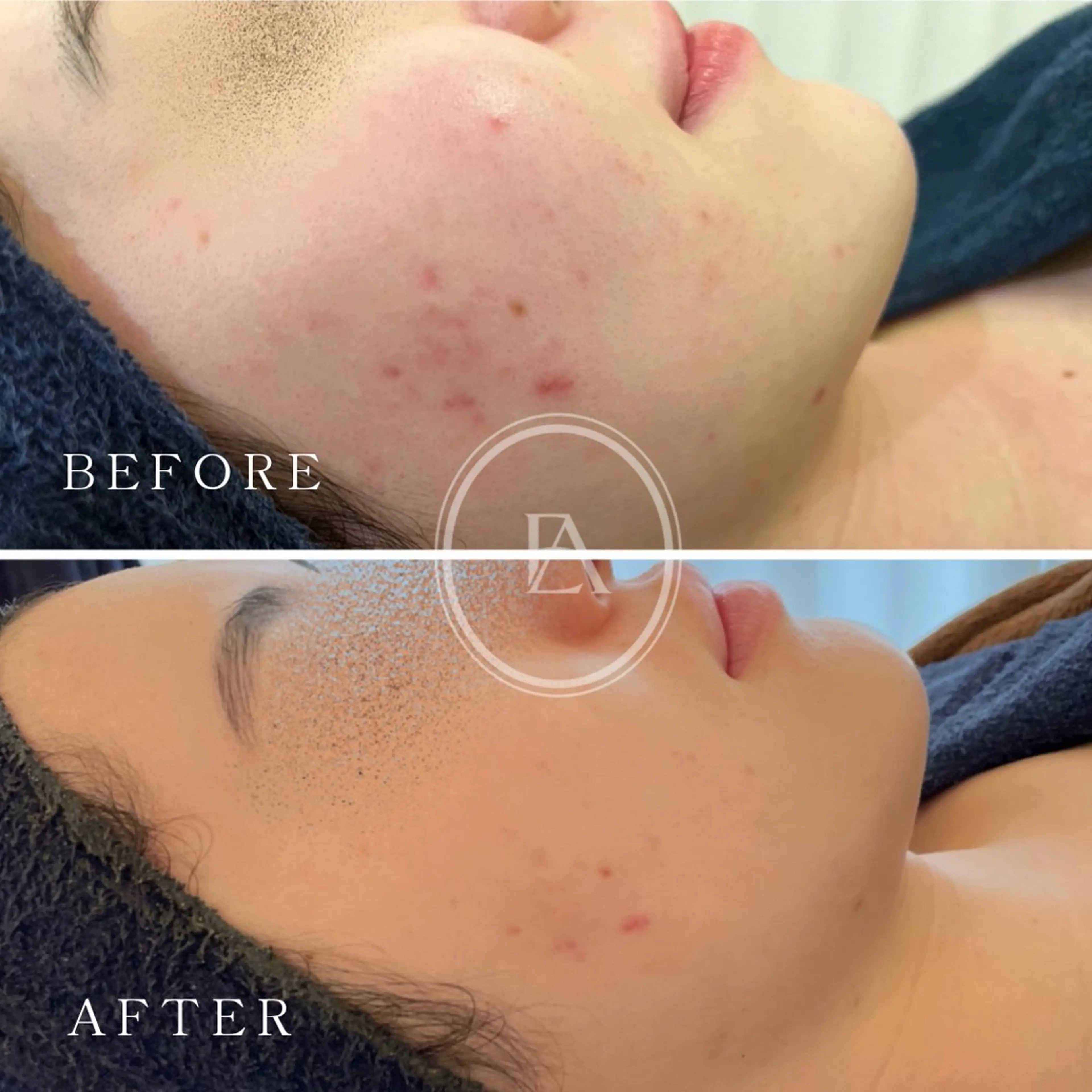 エステ エストリア 所沢店のエステ・リラクイメージ