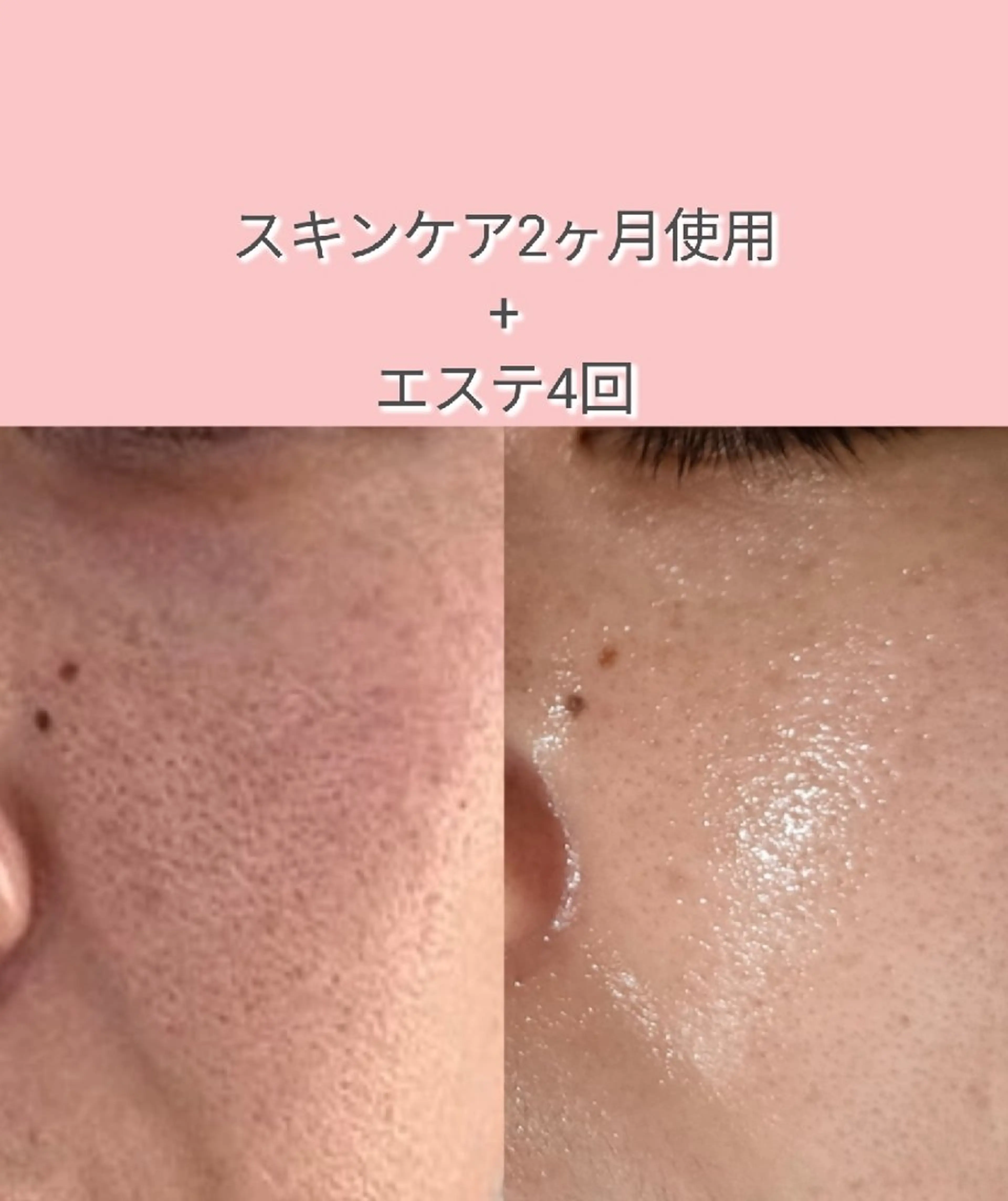 【カウンセリング.お土産付き🎁】お肌の相談だけでも大歓迎 ܀ꕤ୭*ご予約、ご来店お待ちしてます。の写真