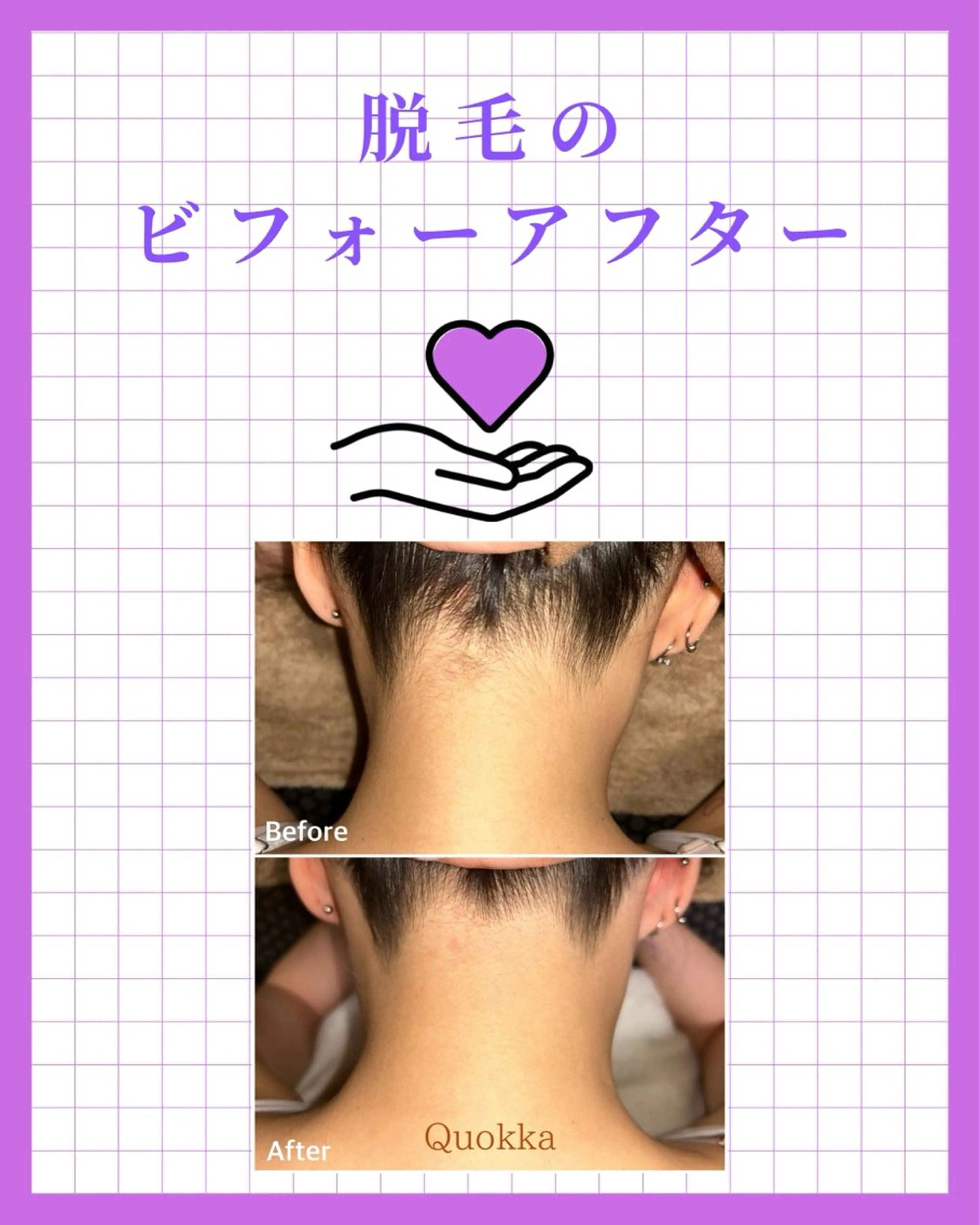 脱毛 Quokka ✴︎ あま市甚目寺のエステ・リラクイメージ