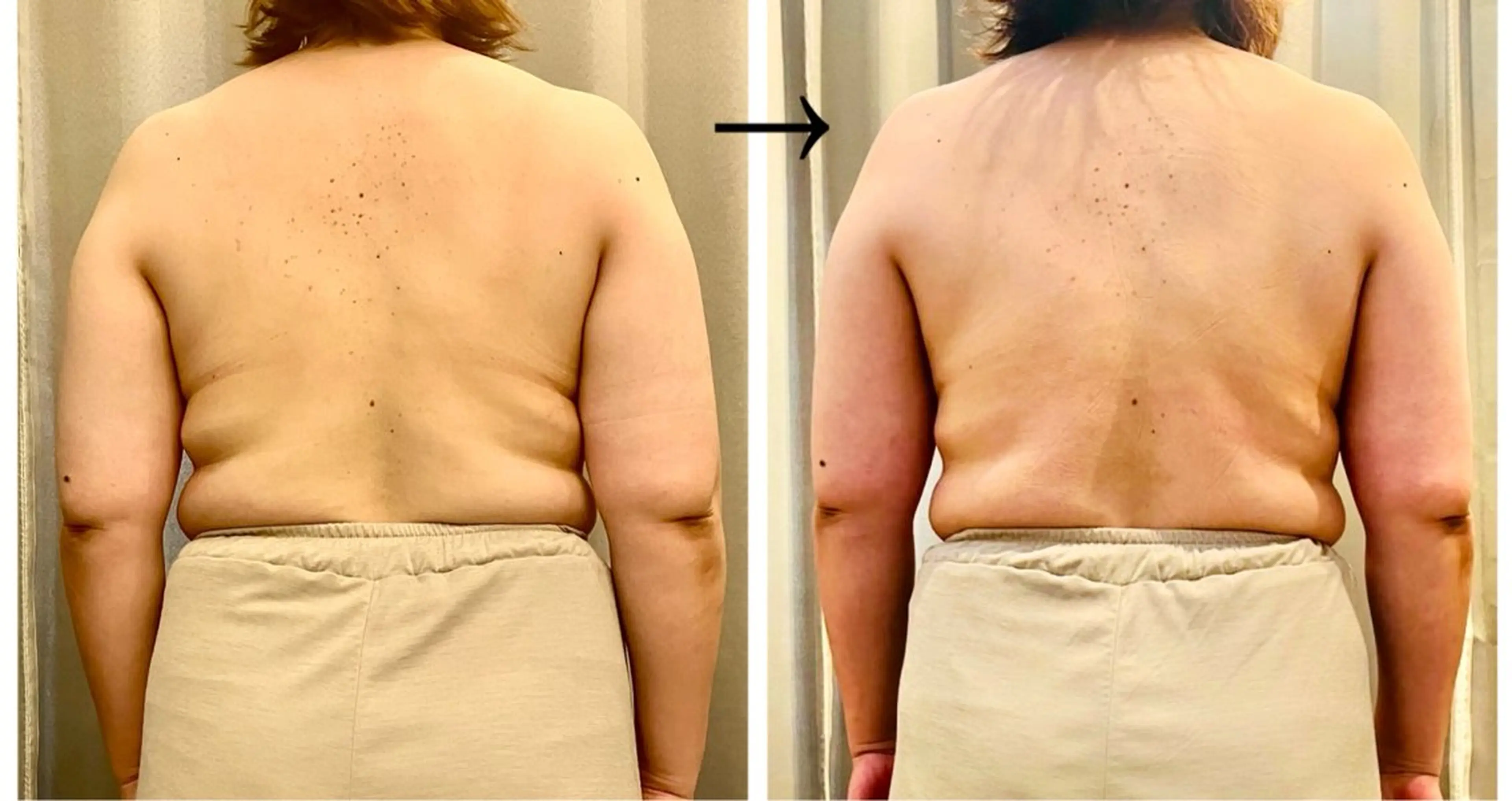 リラク infinity所属・Infinity インフィニティのエステ・リラクイメージ