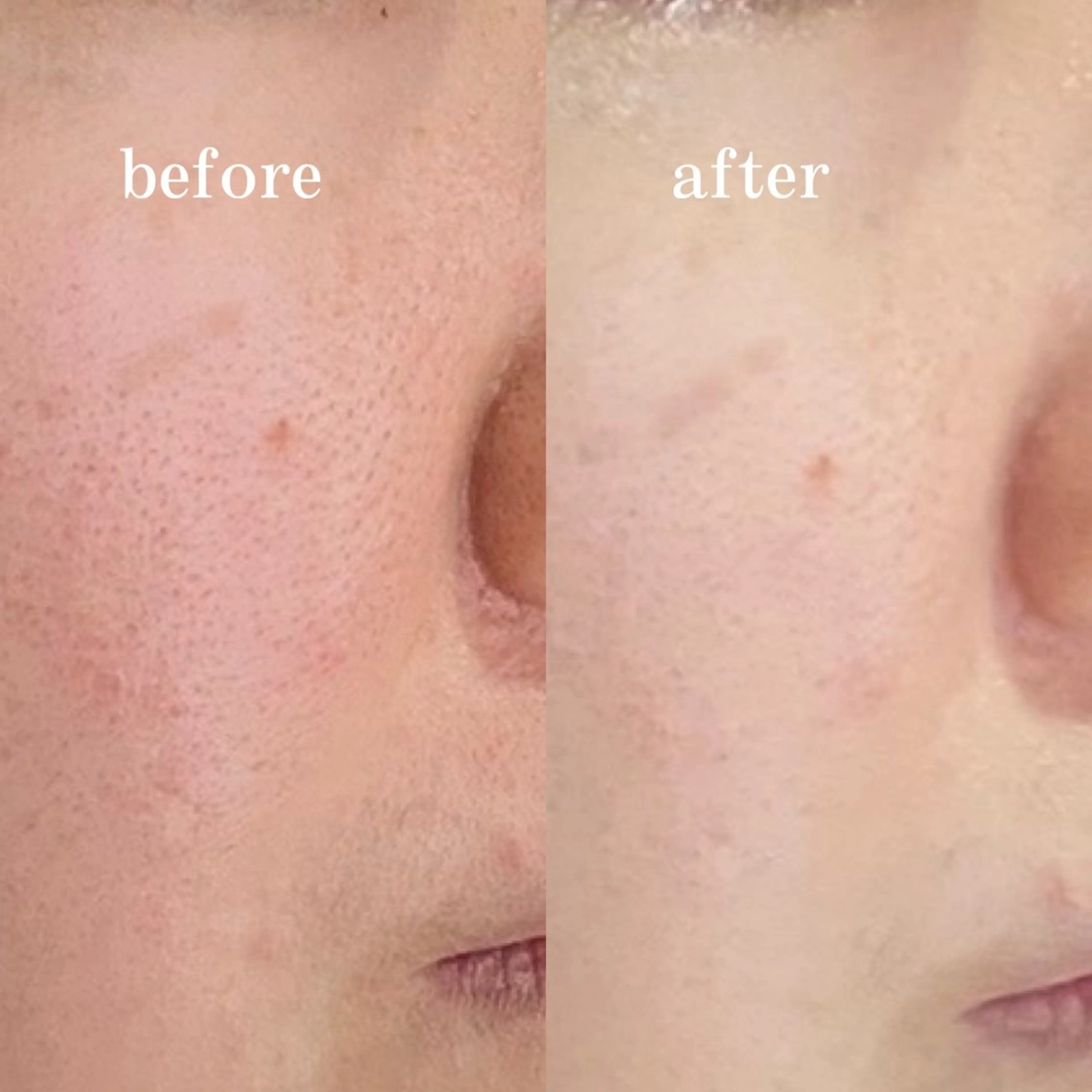 エステ バストサロン KLINGEL大国町のエステ・リラクイメージ