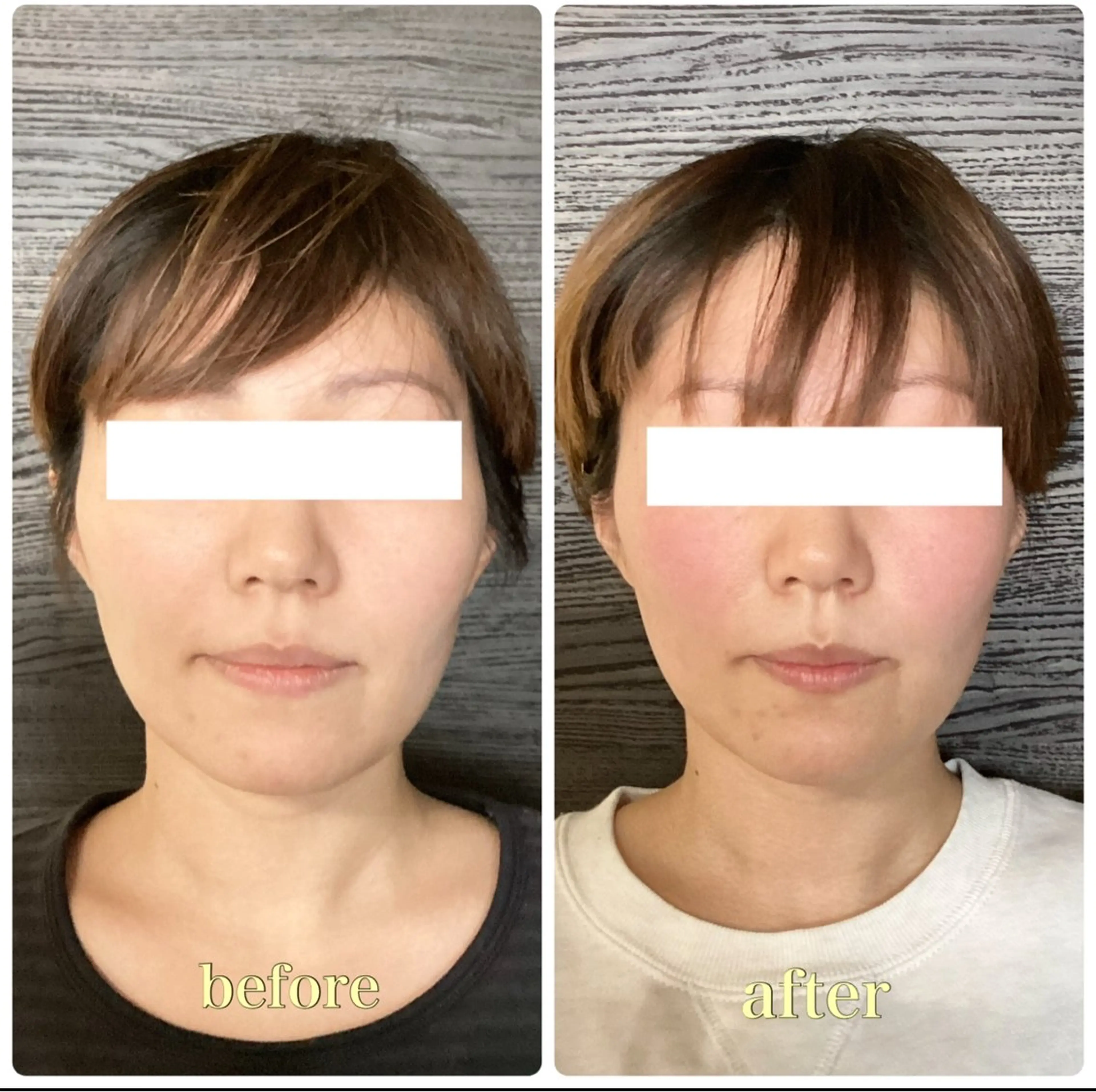 エステ リラク ルコナビューティ所属・小顔・歪み専門　井元 朋子のエステ・リラクイメージ