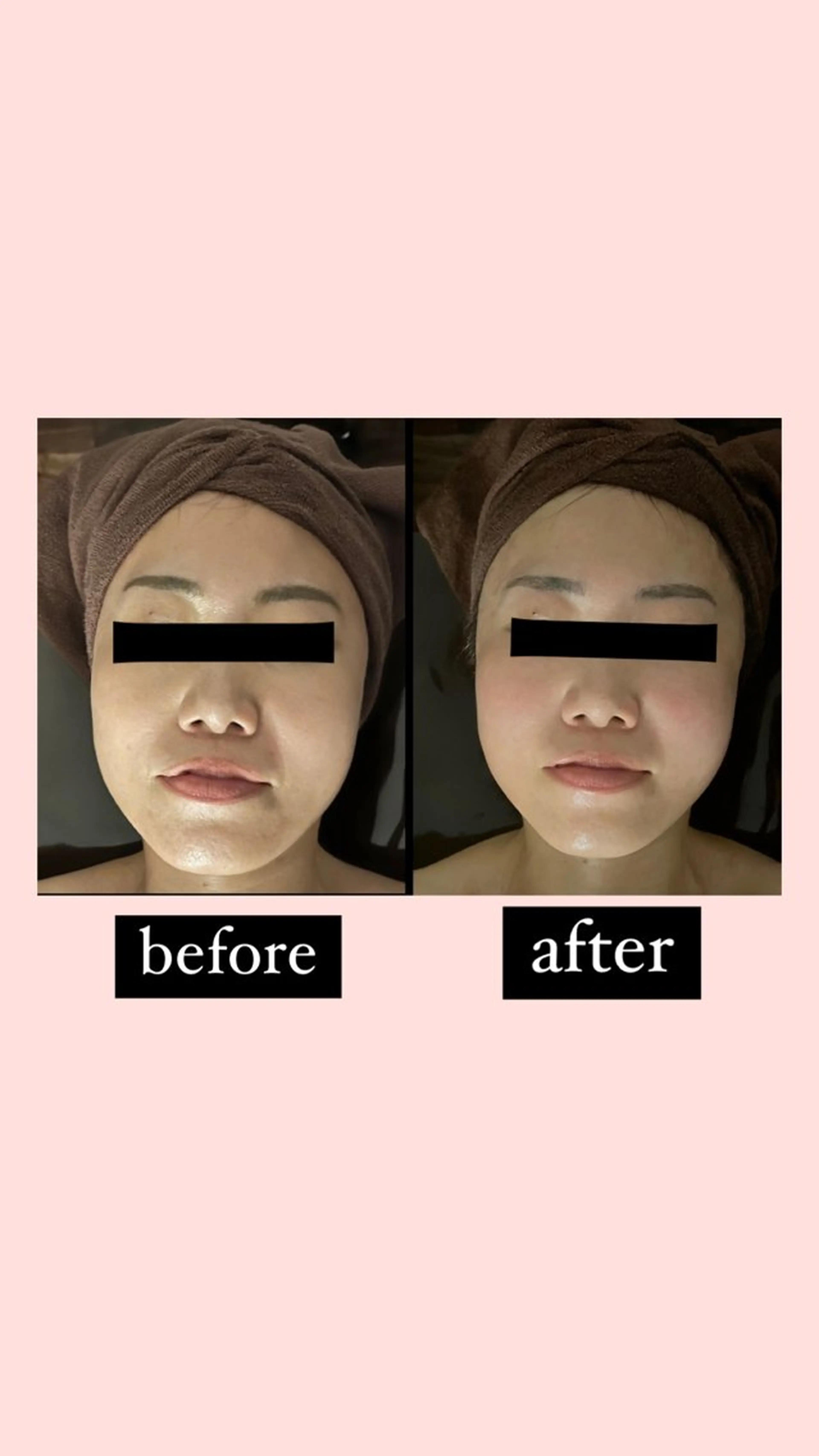 美骨＆小顔矯正サロン　Clarte所属・骨から若返る美骨＆ 小顔サロンクラルテのエステ・リラクイメージ