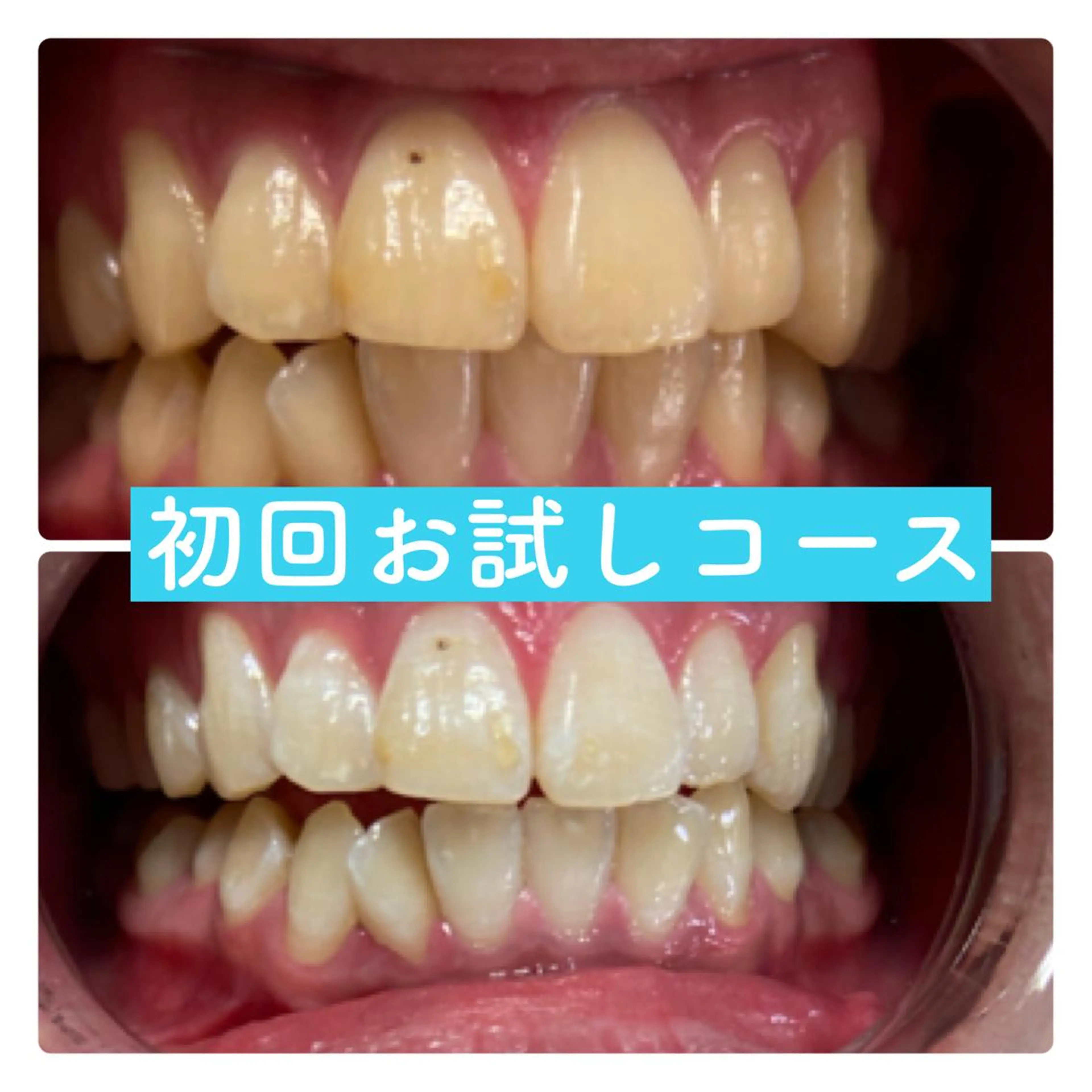 PLATINUM Beauty 横浜店所属・ホワイトニングルーム 横浜店のその他イメージ