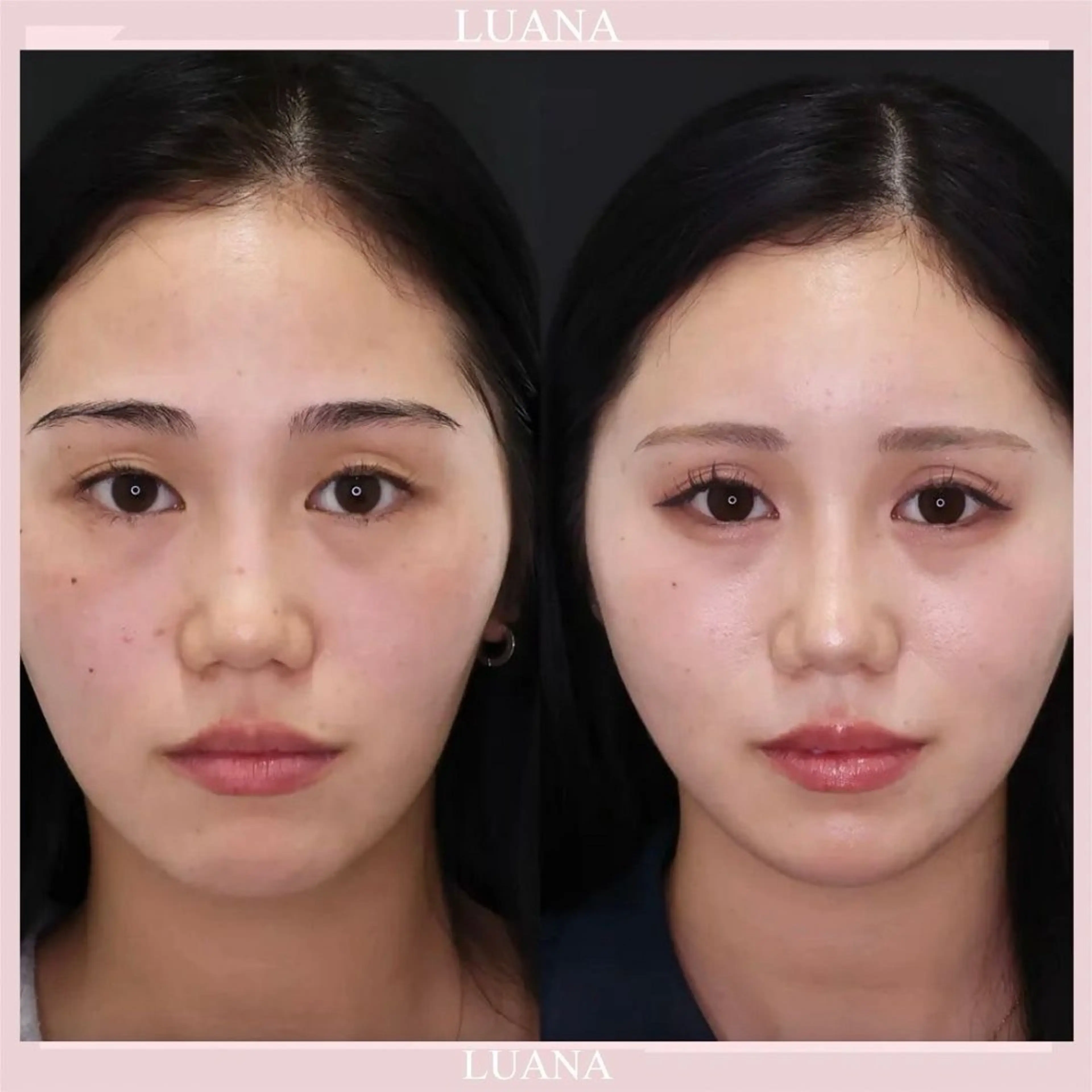 エステ リラク 脱毛&シェービング専門店 心斎橋所属・脱毛&シェービング 専門店LUANAのエステ・リラクイメージ