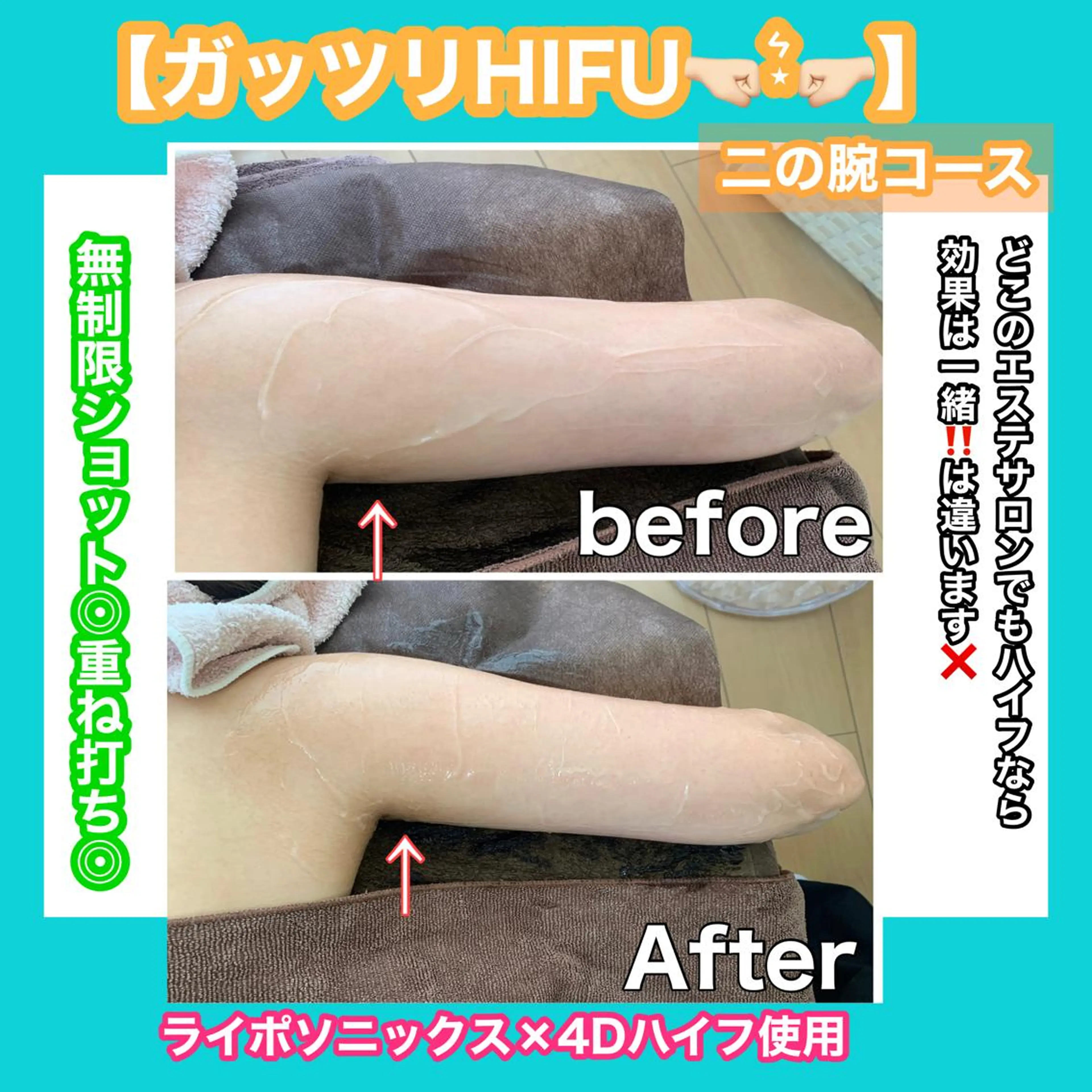 痩身/脱毛/ネイル HARUKAのエステ・リラクイメージ