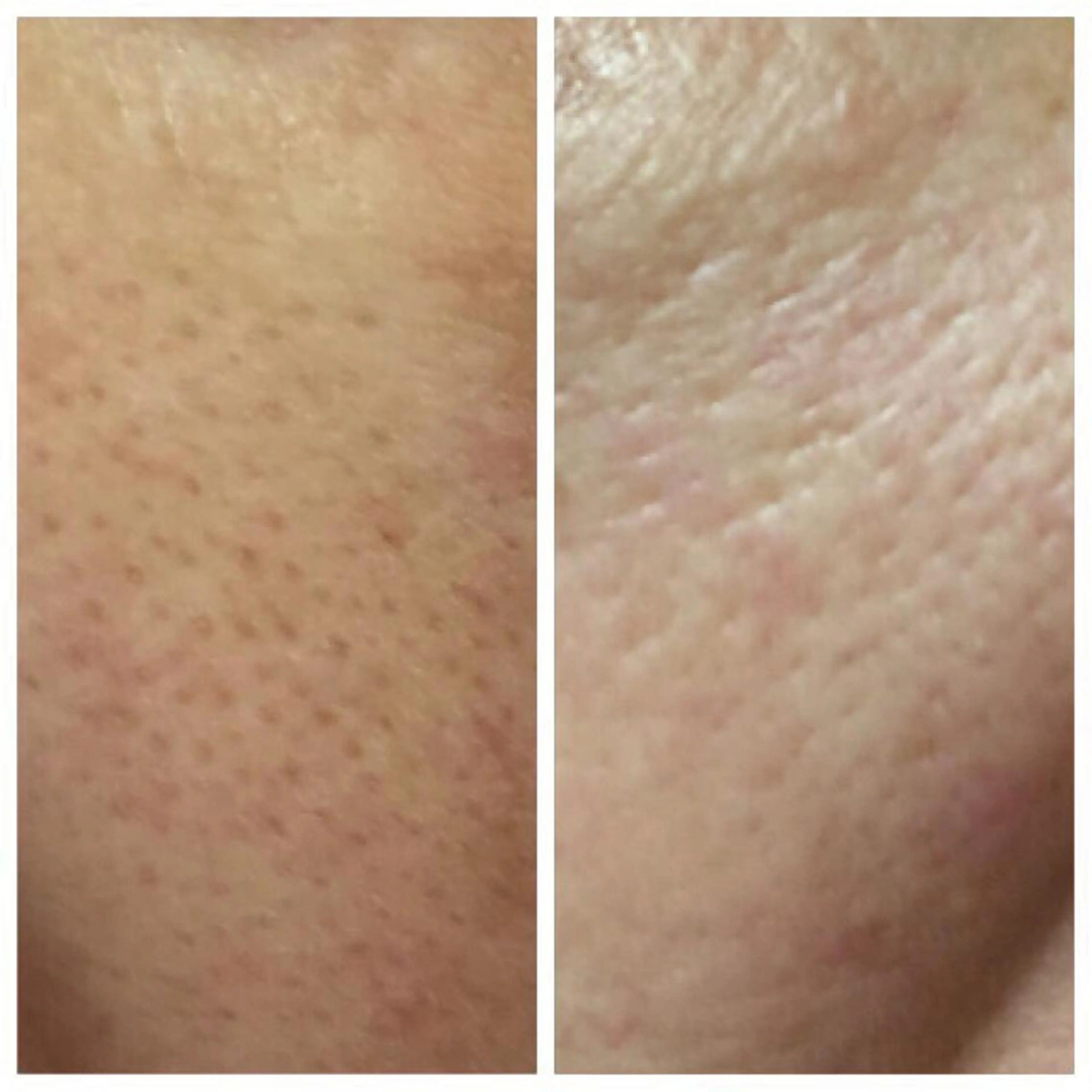 ESPOIR エスポワールのエステ・リラクイメージ