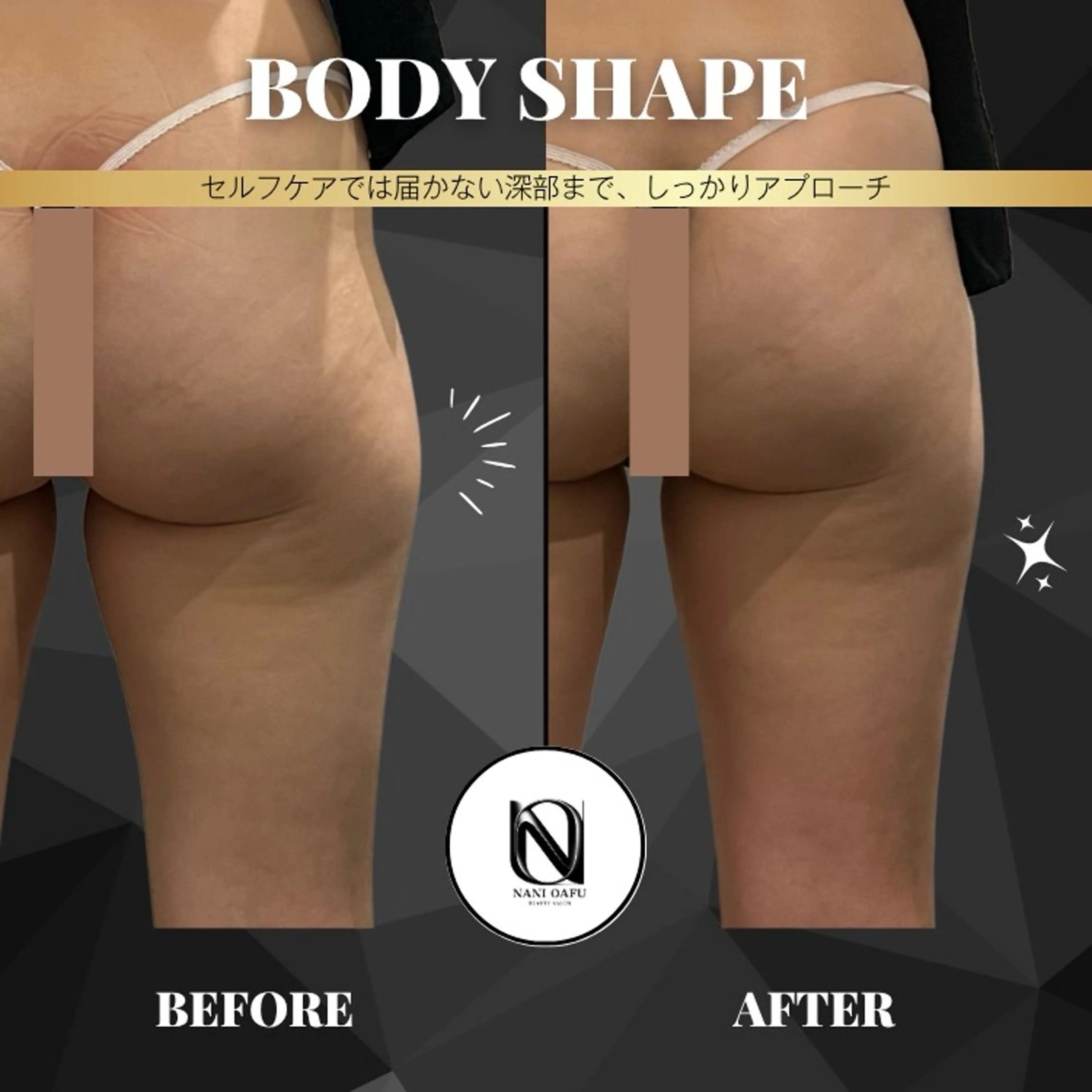 【BODY SHAPE🦵】下半身集中プラン｜太もも・ふくらはぎ・ヒップ特化の構造アプローチ◎初回体験OK✨の写真