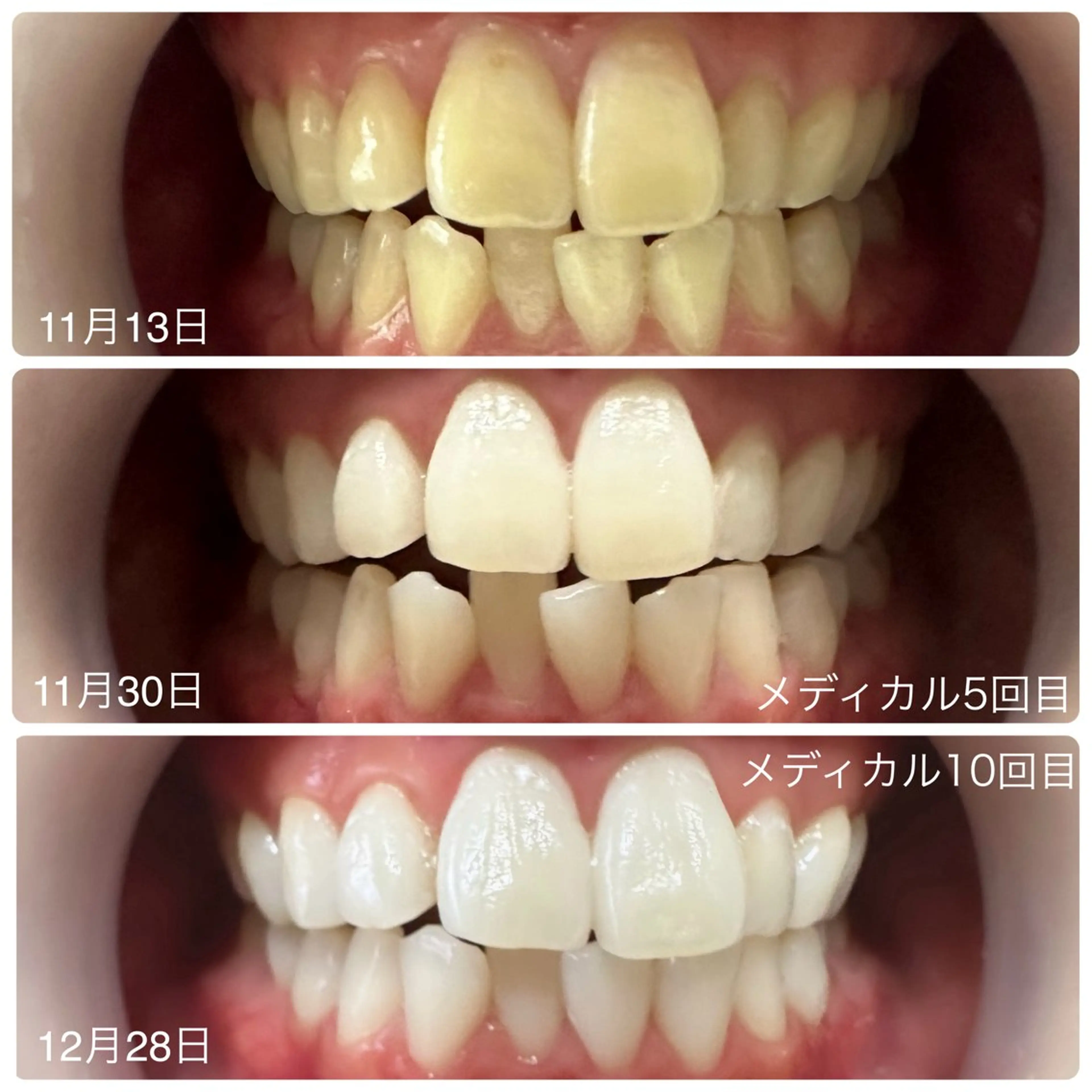 マツエク・マツパ その他 歯のホワイトニング専門店＆white所属・歯のホワイトニング 専門店&whiteのその他イメージ