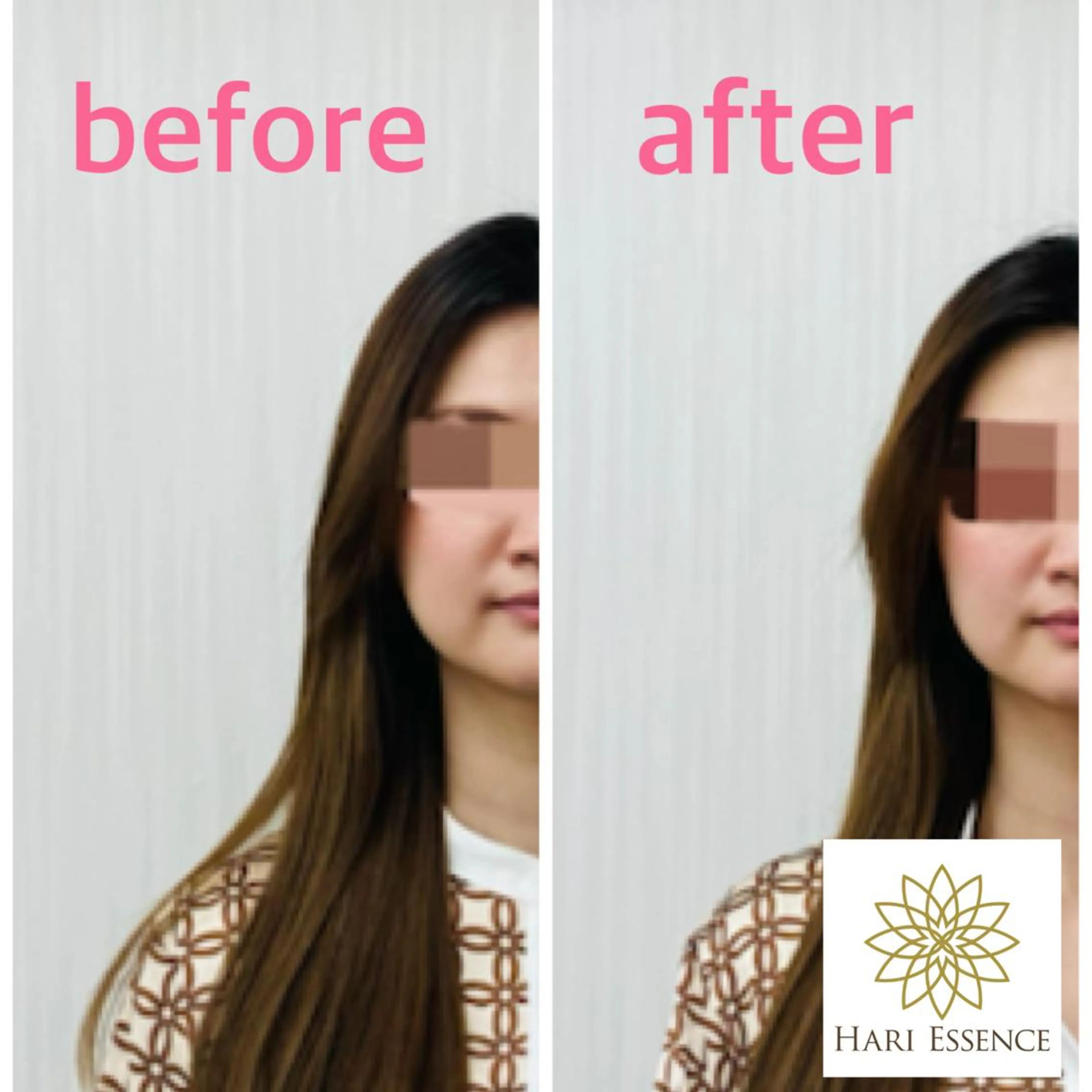 美容鍼灸専門院　ハリエッセンス所属・美容鍼専門鍼灸院 ハリエッセンスのその他イメージ