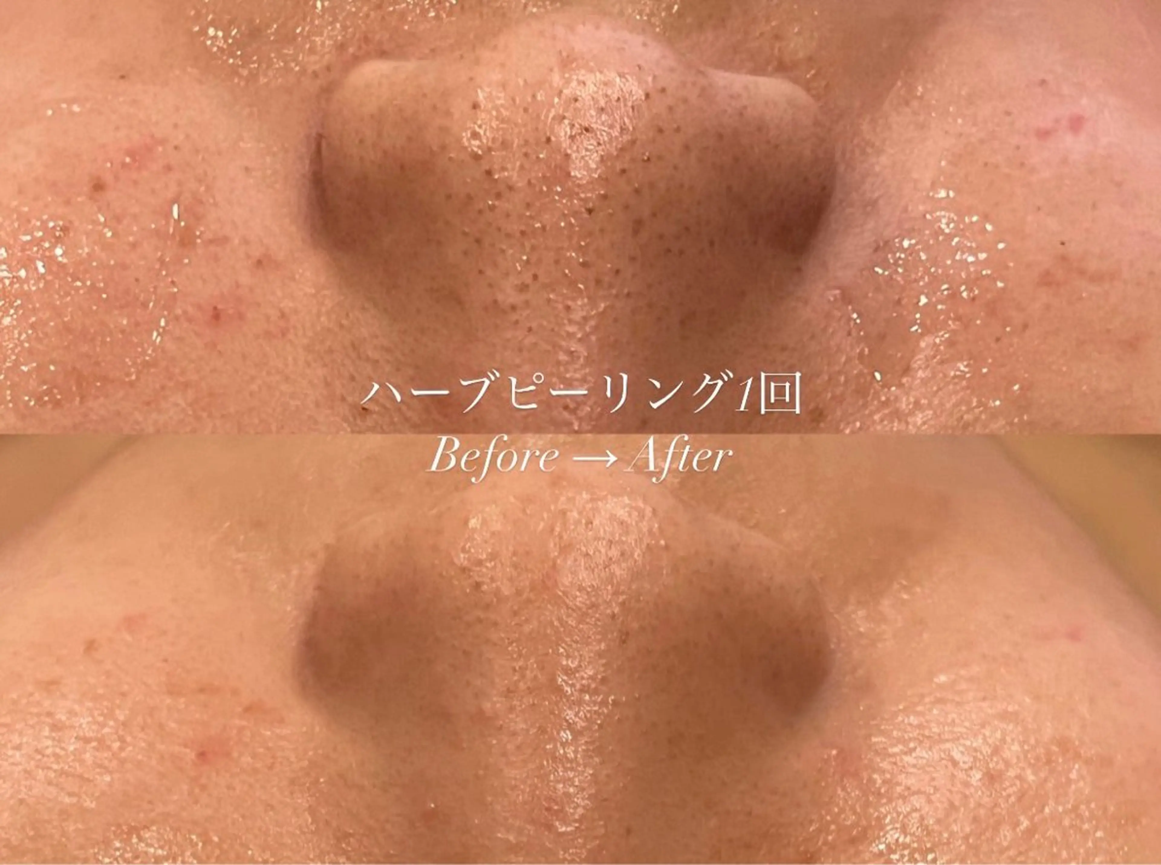 エステ 産後/ツヤ肌/子連れ /保育士在籍サロンのエステ・リラクイメージ