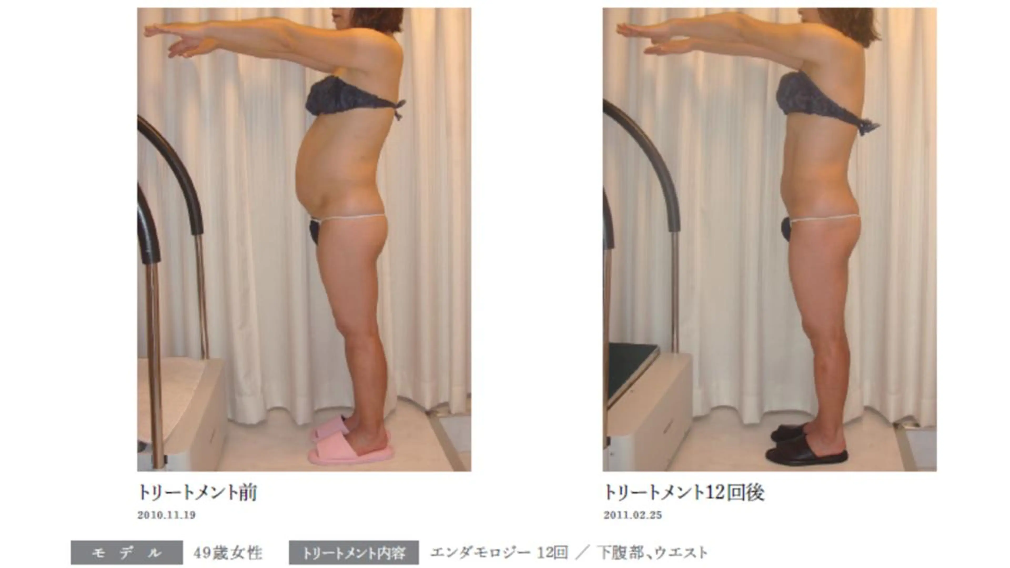 オレンジバナナ 亀貝インター店のエステ・リラクイメージ