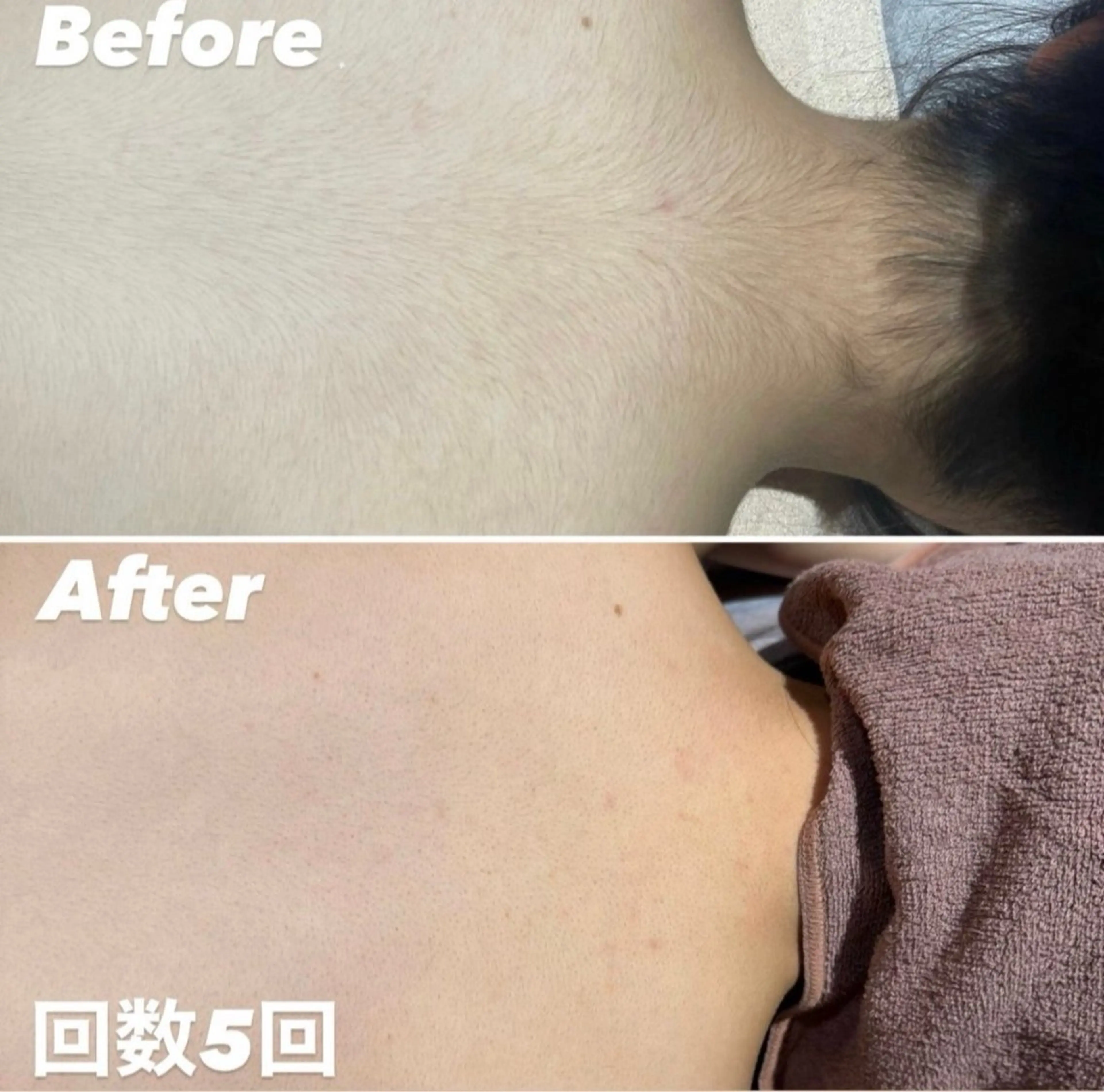 R-four所属・山本 萌奈のエステ・リラクイメージ