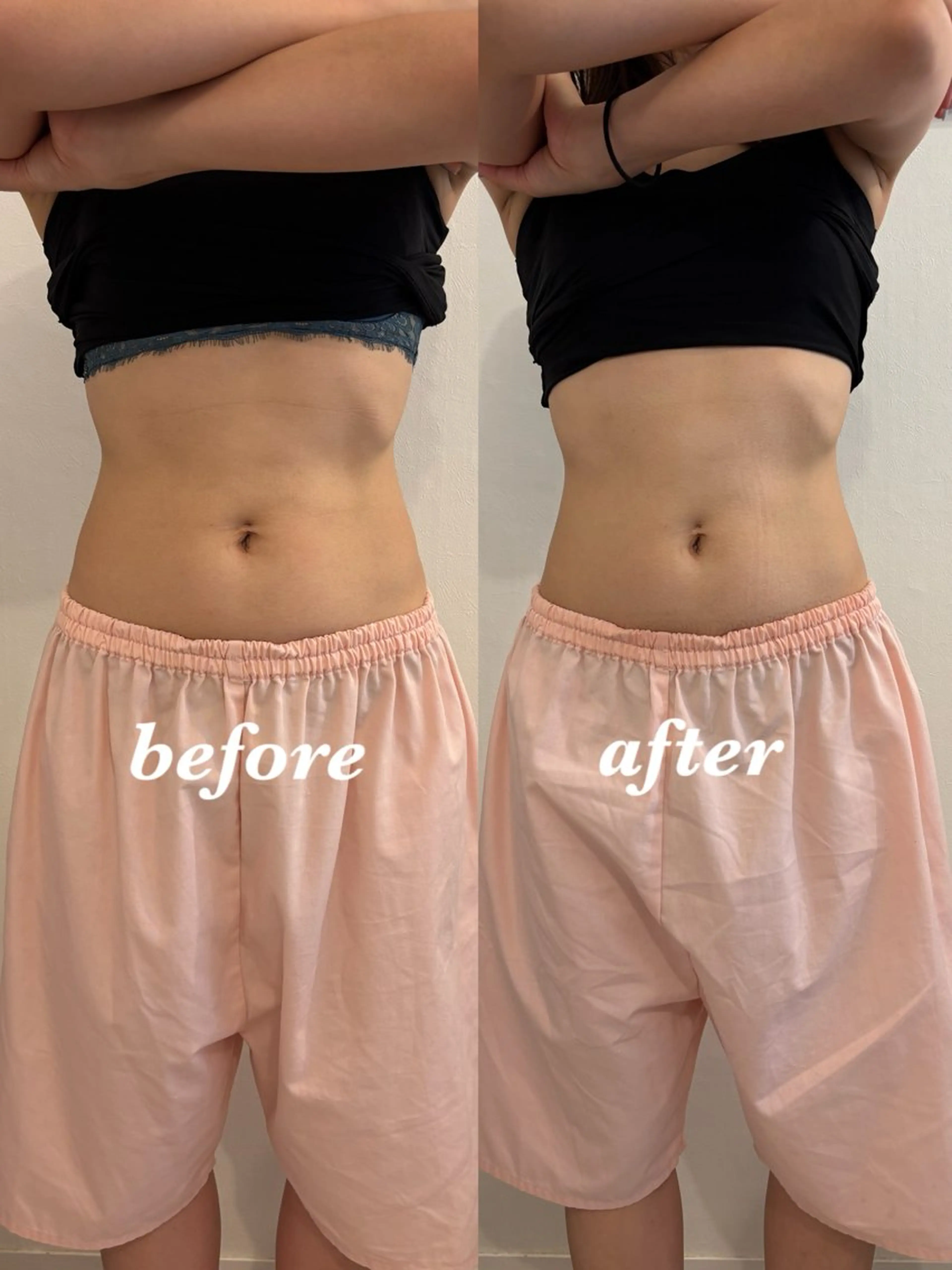 エステ リラク 腸活サポート みなみののエステ・リラクイメージ