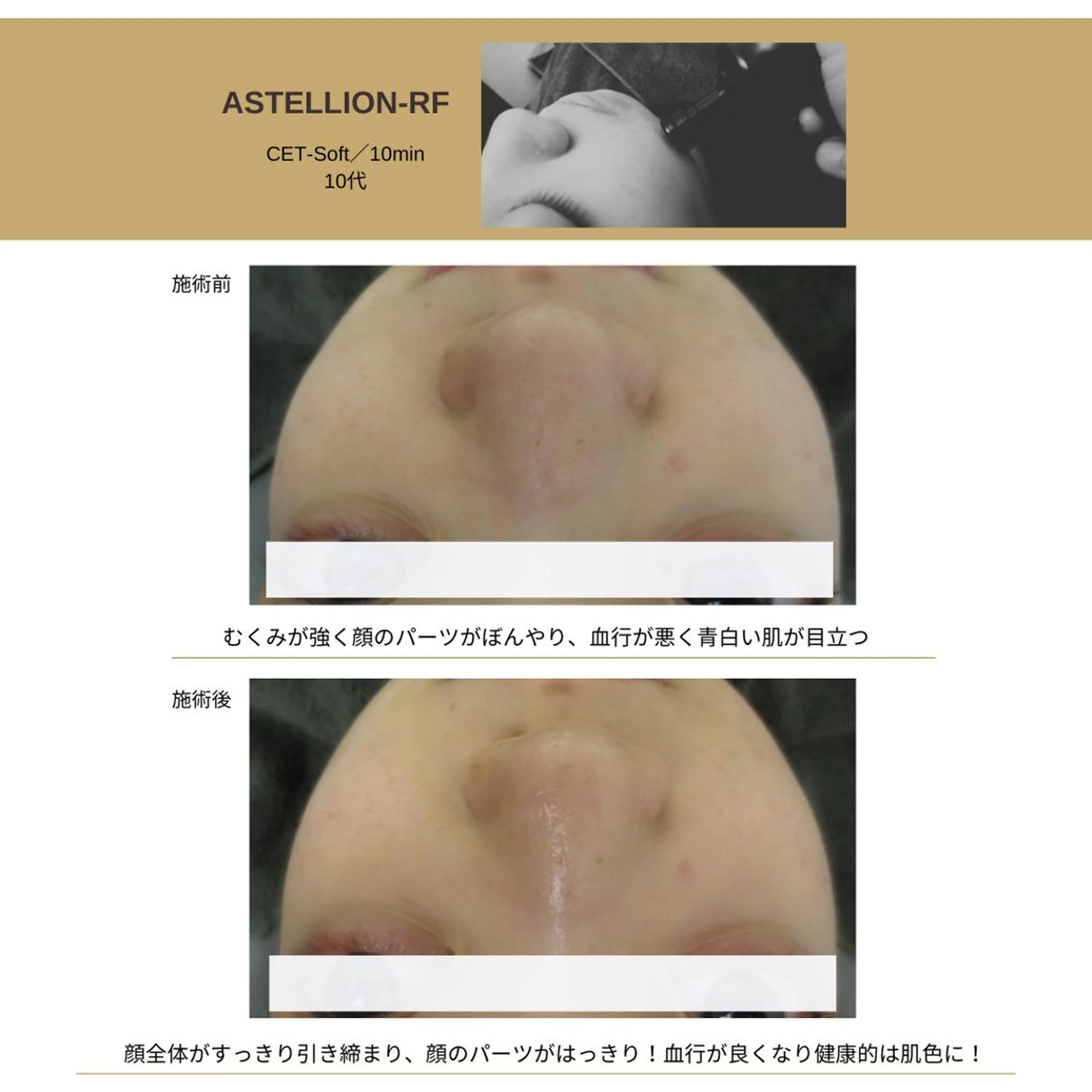 Sylphya (シルフィア)のエステ・リラクイメージ