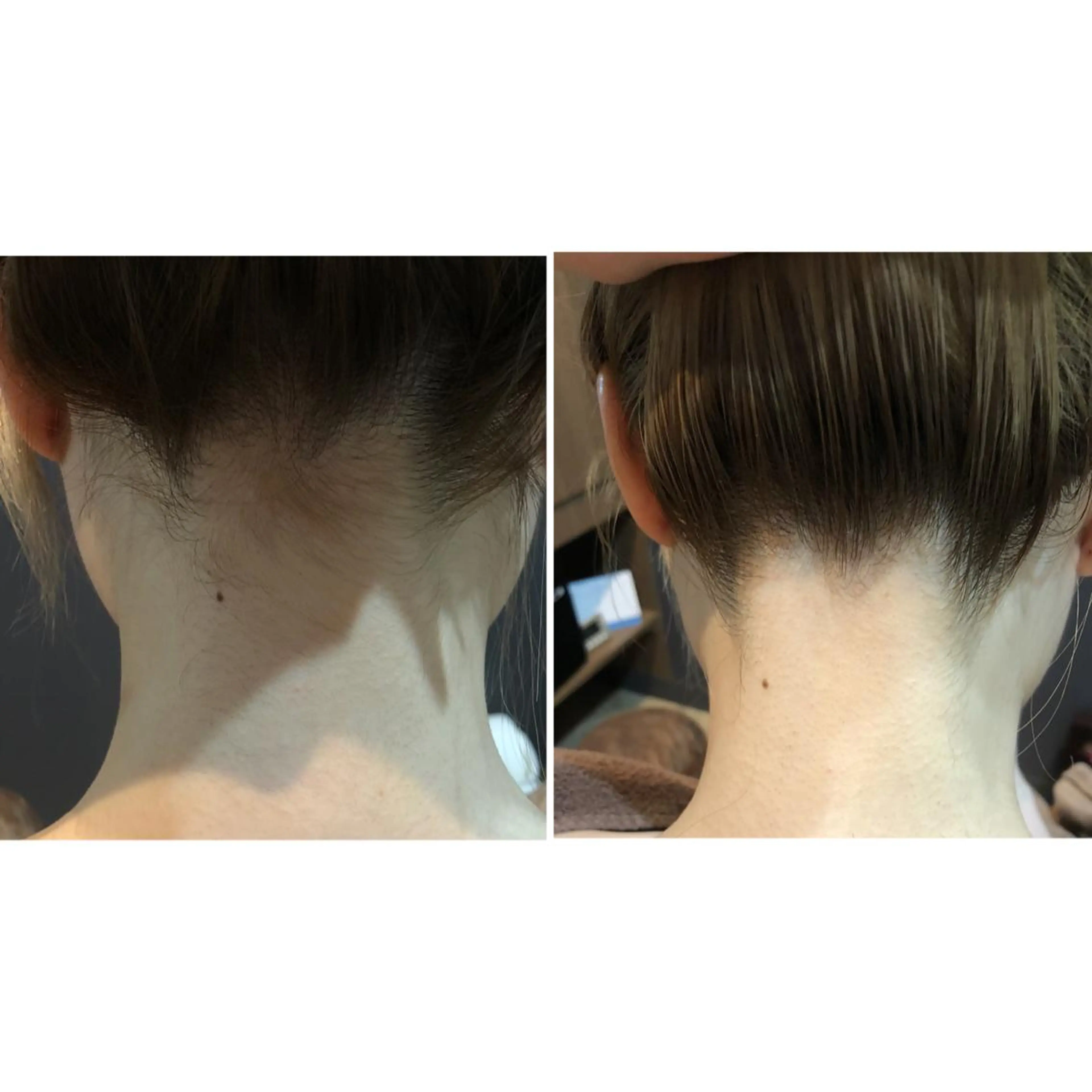 ✨シェービング 美肌ケア✨菊地の眉毛・アイブロウイメージ