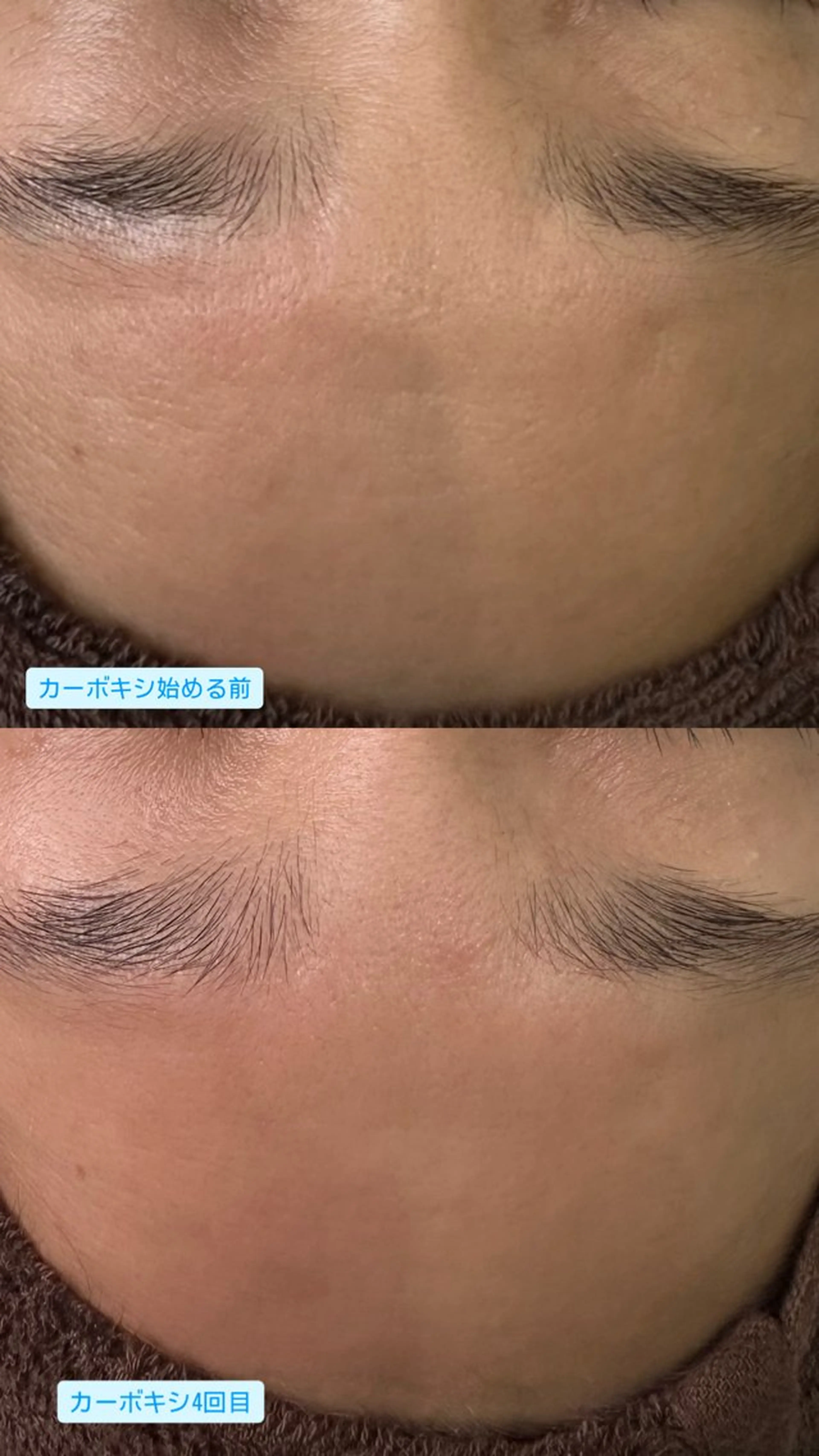 BIREINA Eyelash  Salon所属・BIREINA 住之江公園のマツエク・マツパデザイン