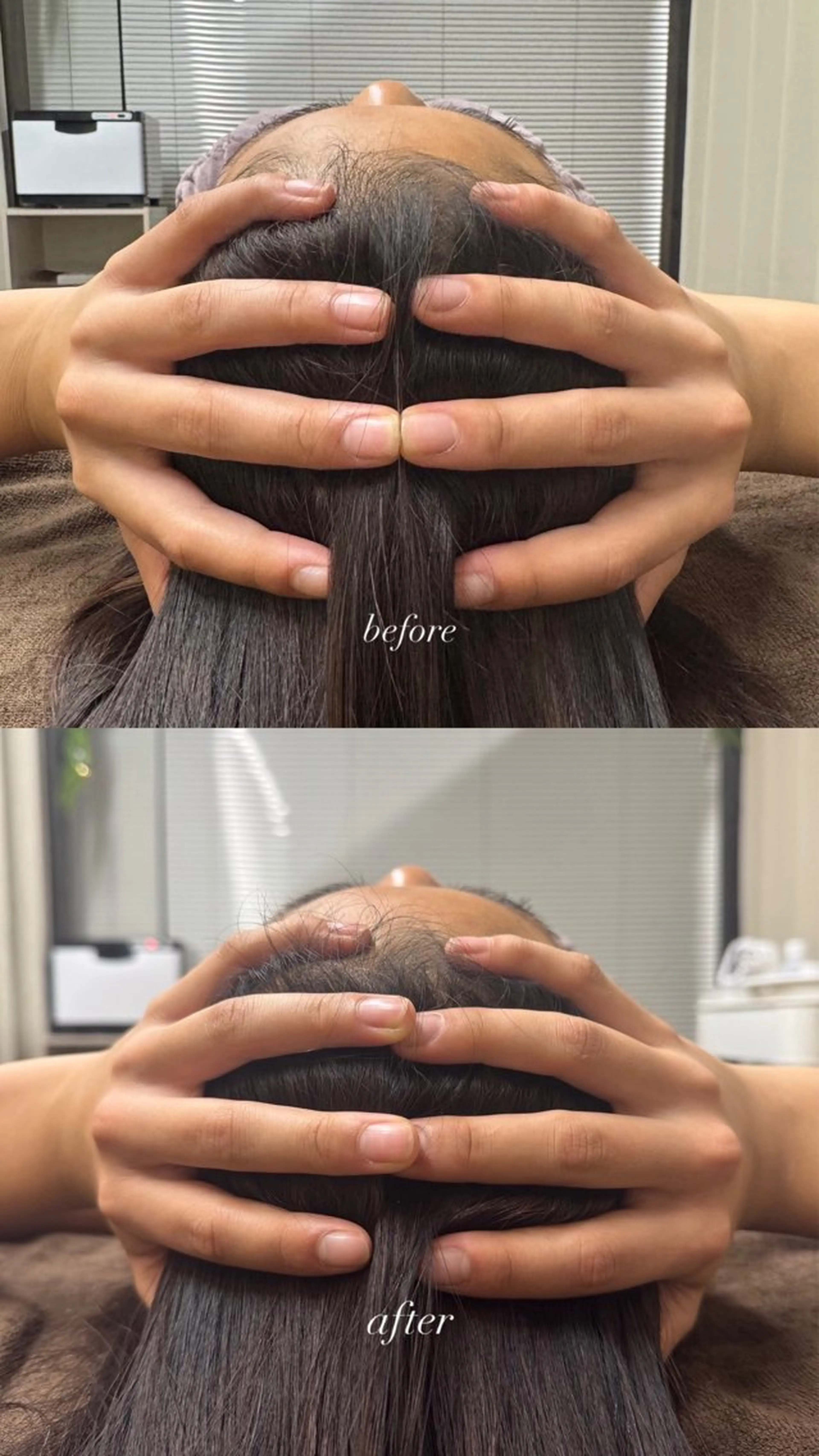 【究極小顔コース⭐︎】3step小顔➕頭蓋骨矯正付き（100min）¥24,200→¥4,950の写真