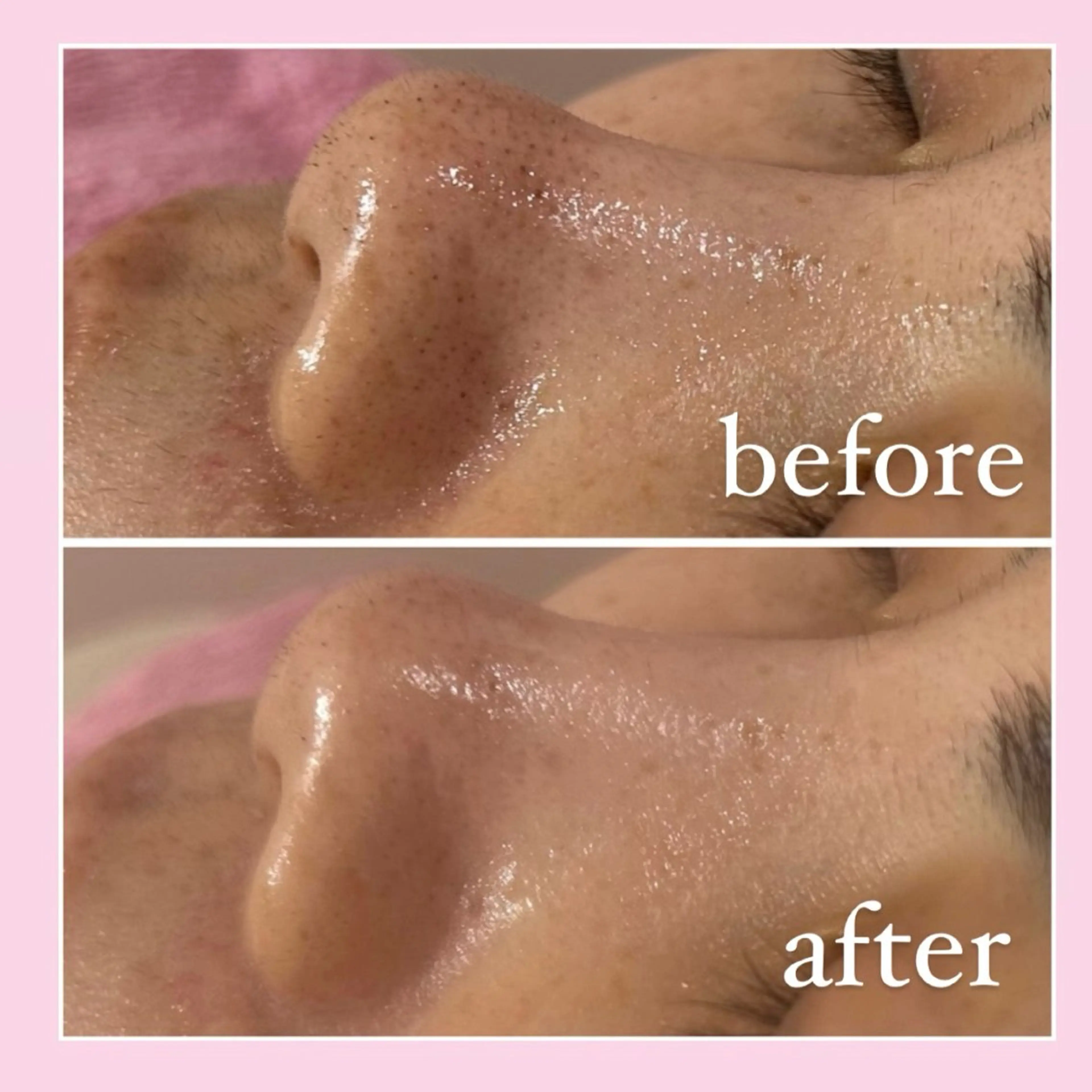 エステ 韓国肌管理専門店　White labo 宝塚店所属・有川 凜のエステ・リラクイメージ