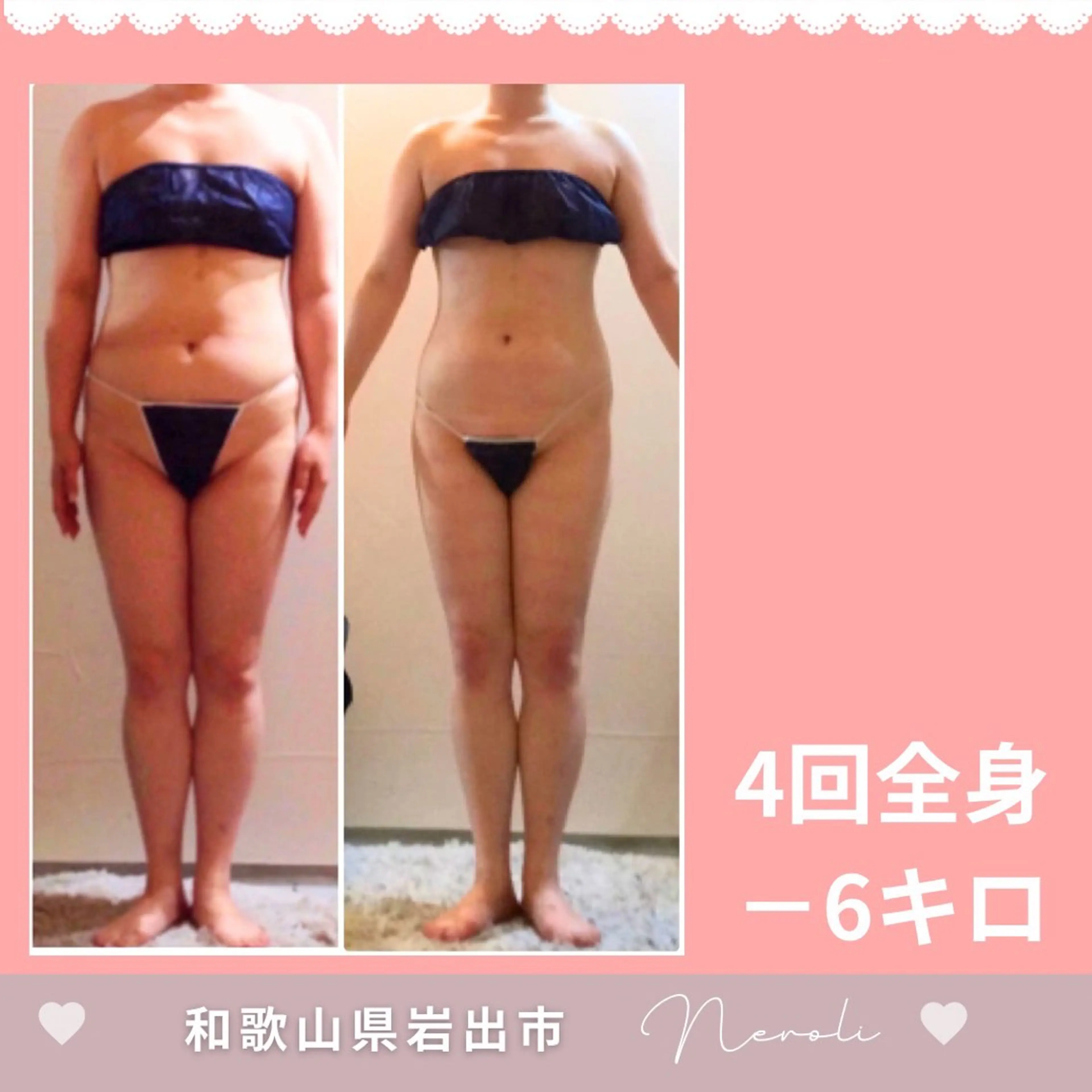 エステ 温活beautyサロンNeroli所属・切らない脂肪吸引🔥 Neroliまりこのエステ・リラクイメージ