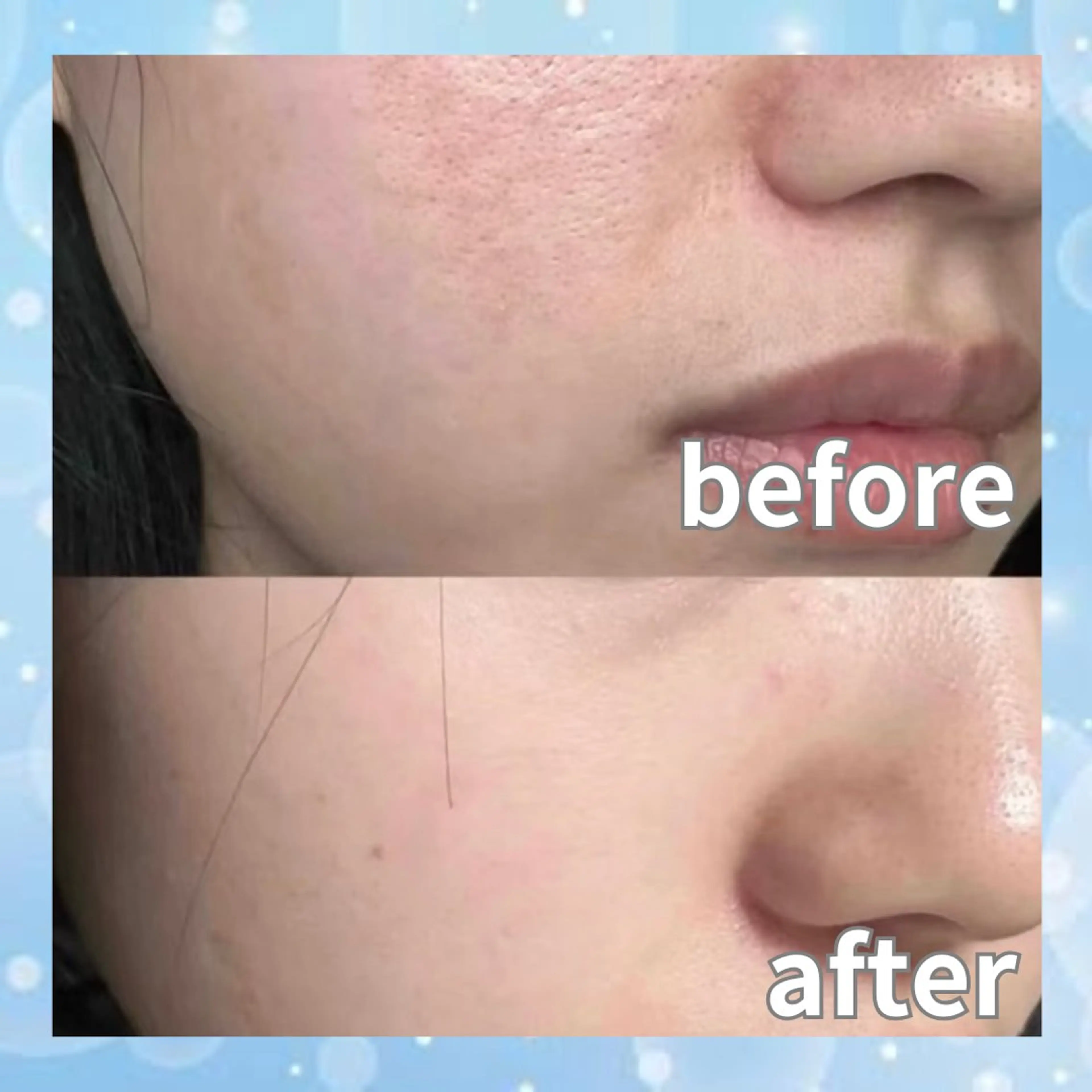 エステ リラク 愛維美水光美肌専門店所属・愛維美水光美肌専門店 メンズレディースokのエステ・リラクイメージ