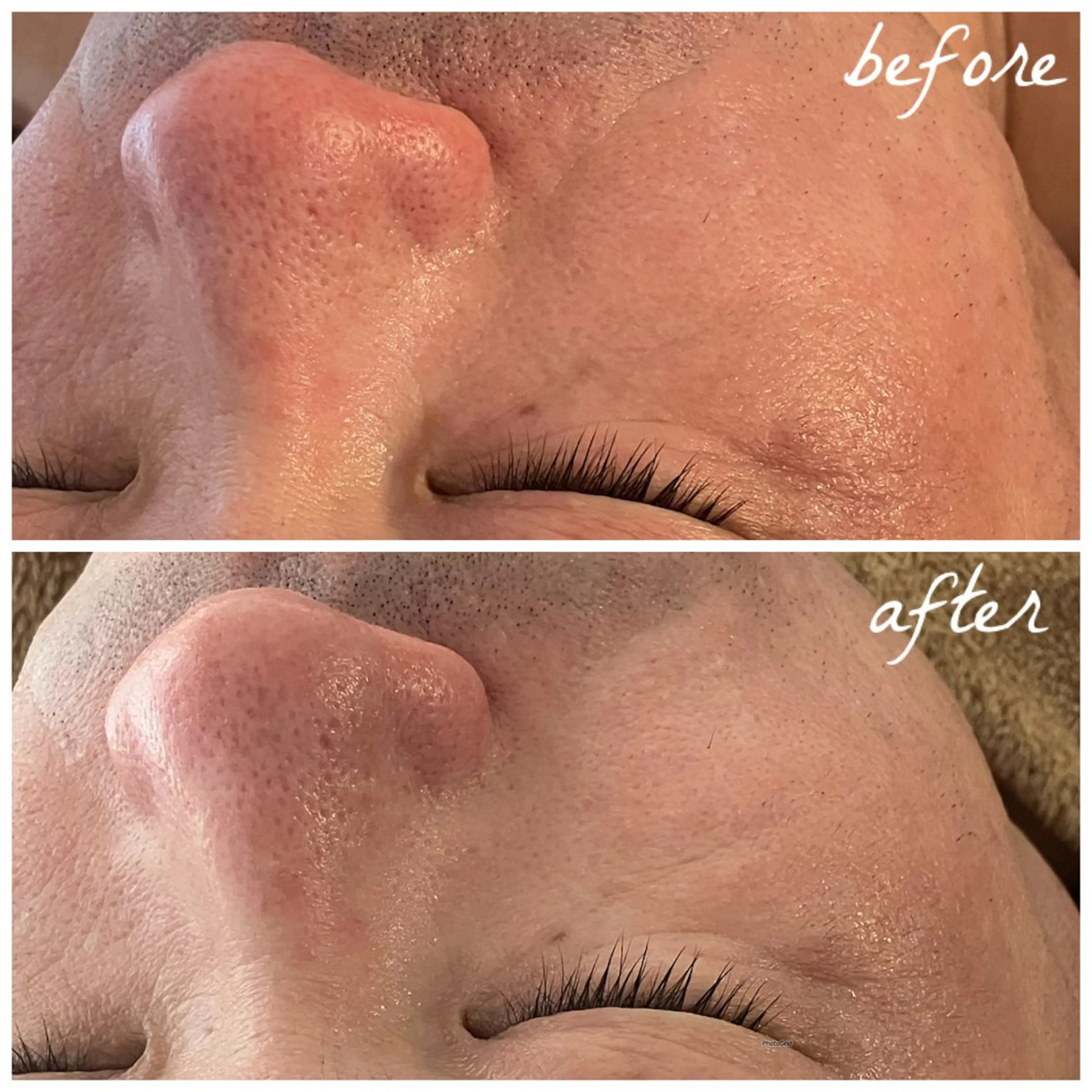 メンズ エステ メナード岐阜茜部 杉浦のエステ・リラクイメージ