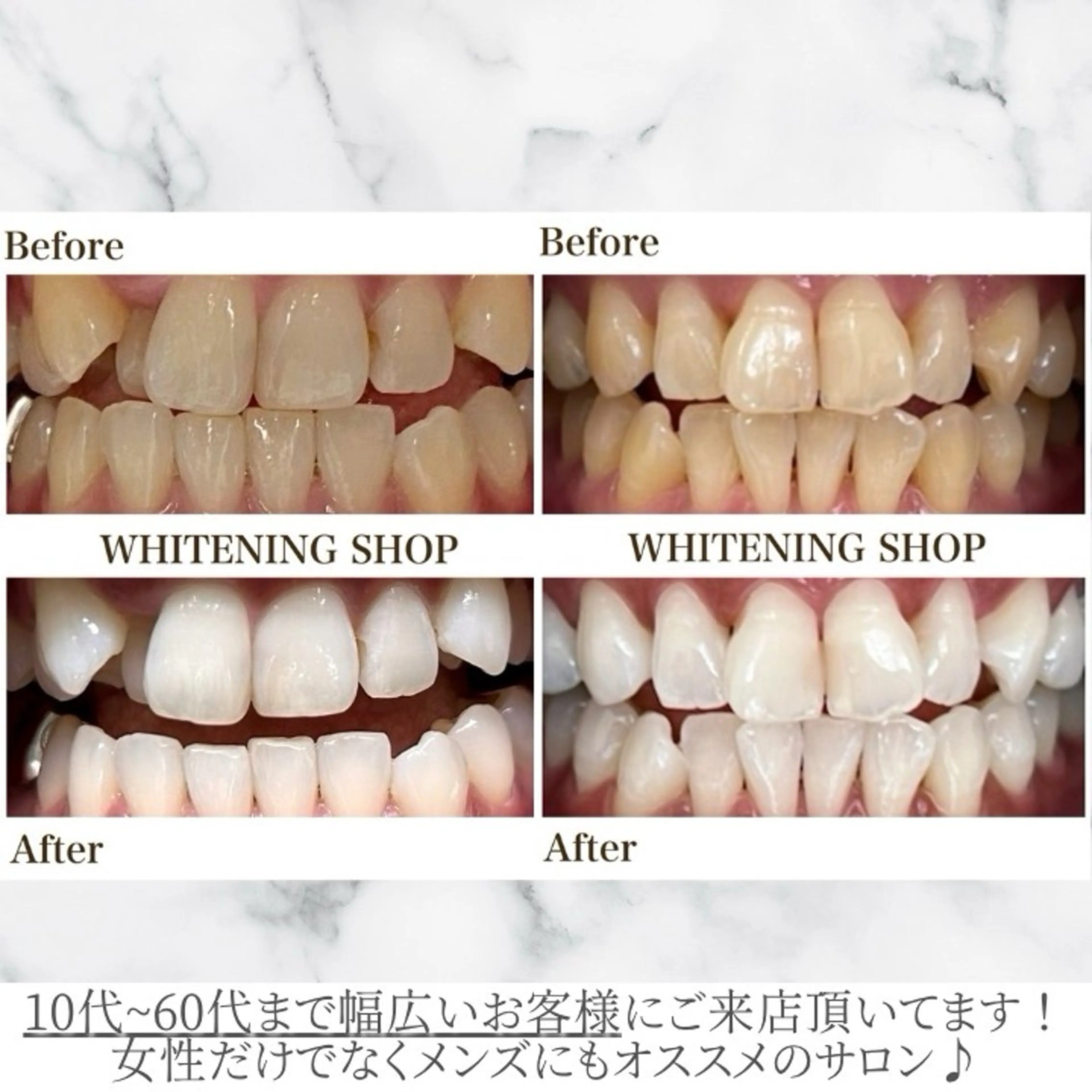 メンズ ホワイトニング ショップくずは店のエステ・リラクイメージ