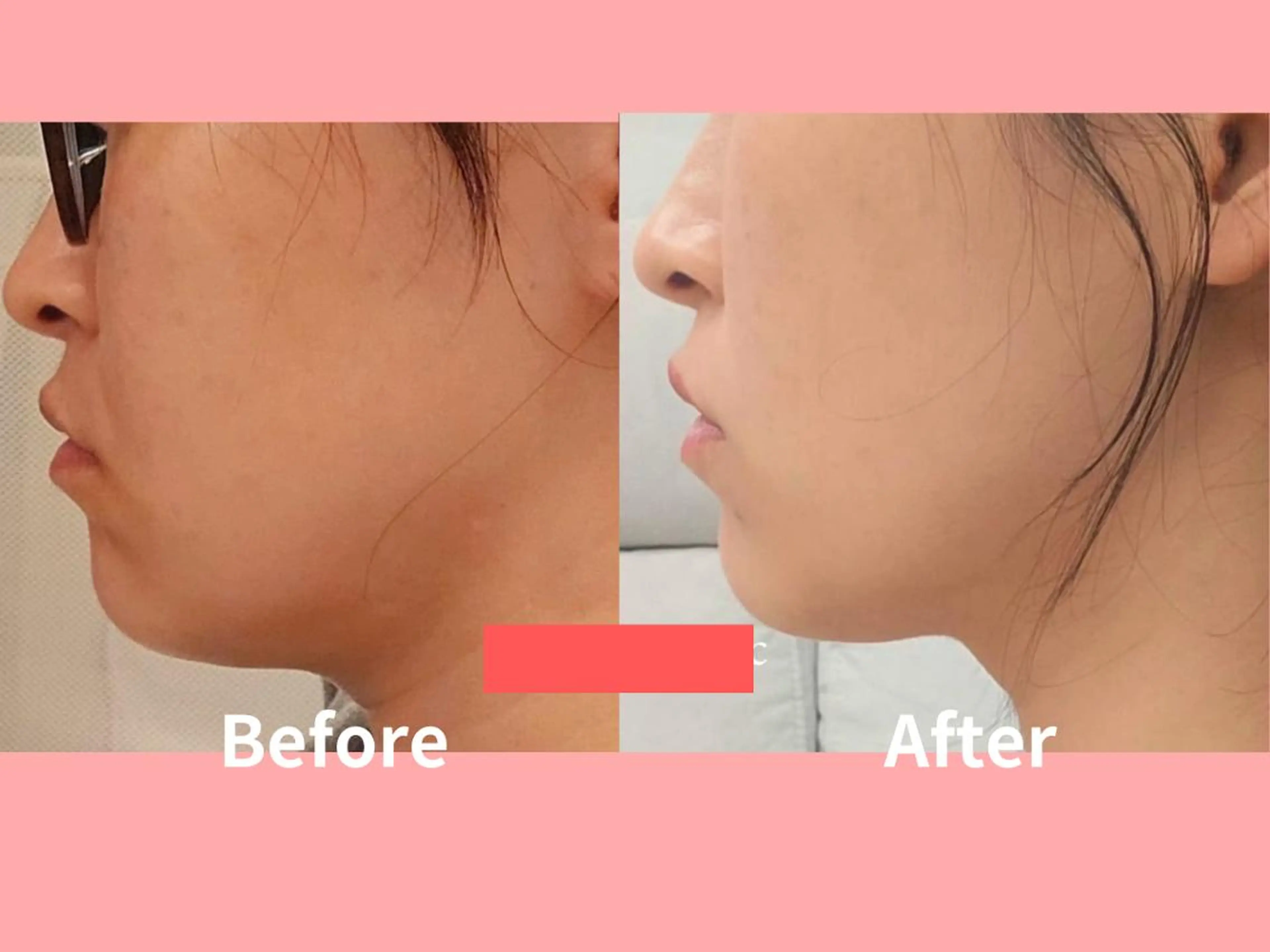 痩身Relives 金町店のその他イメージ