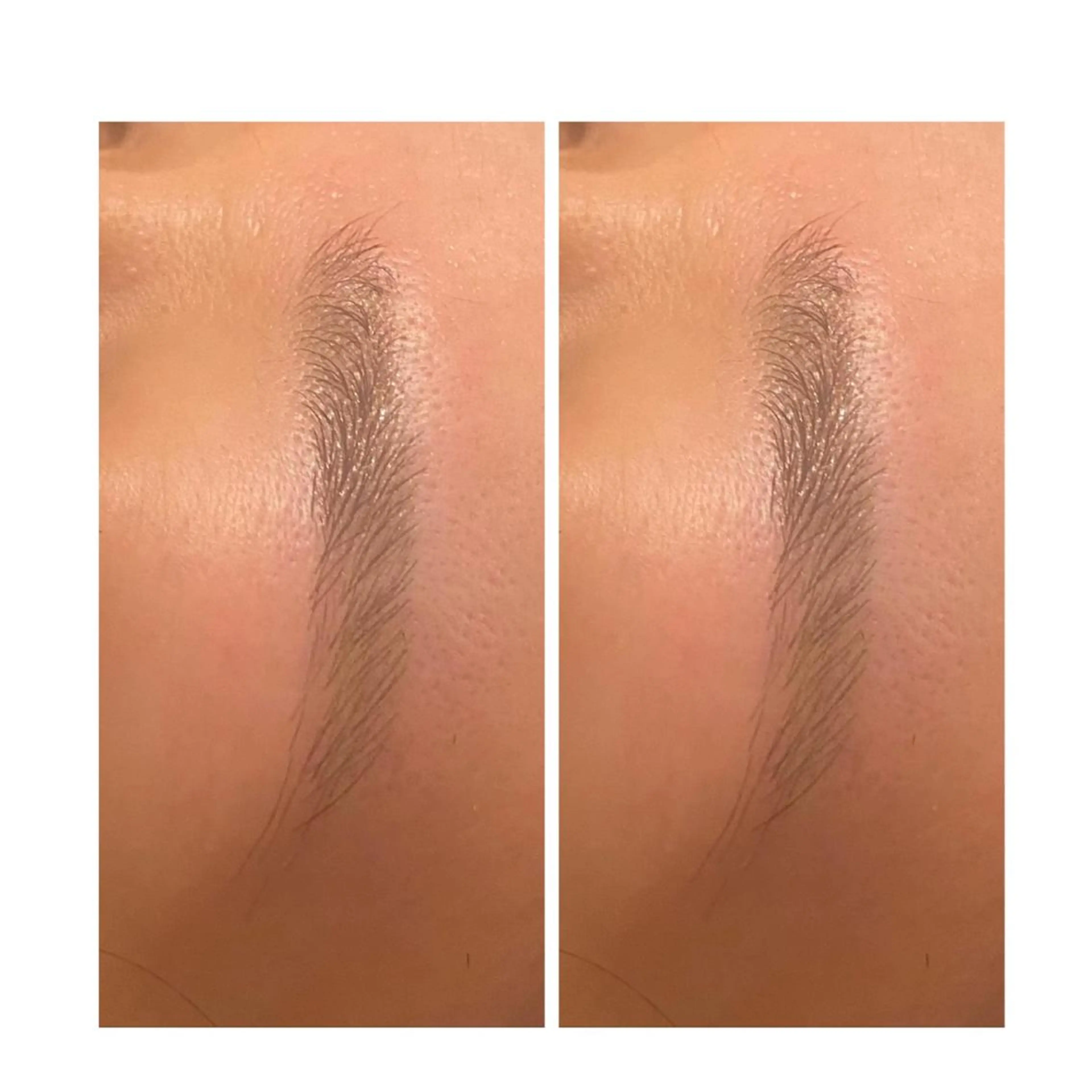 アイブロウ ハーブピーリング/韓国肌管理/フェイシャル/毛穴洗浄/眉毛/顔脱毛【糸脱毛専門】rev所属・ハーブピーリング🌹 毛穴洗浄❤️眉waxのエステ・リラクイメージ