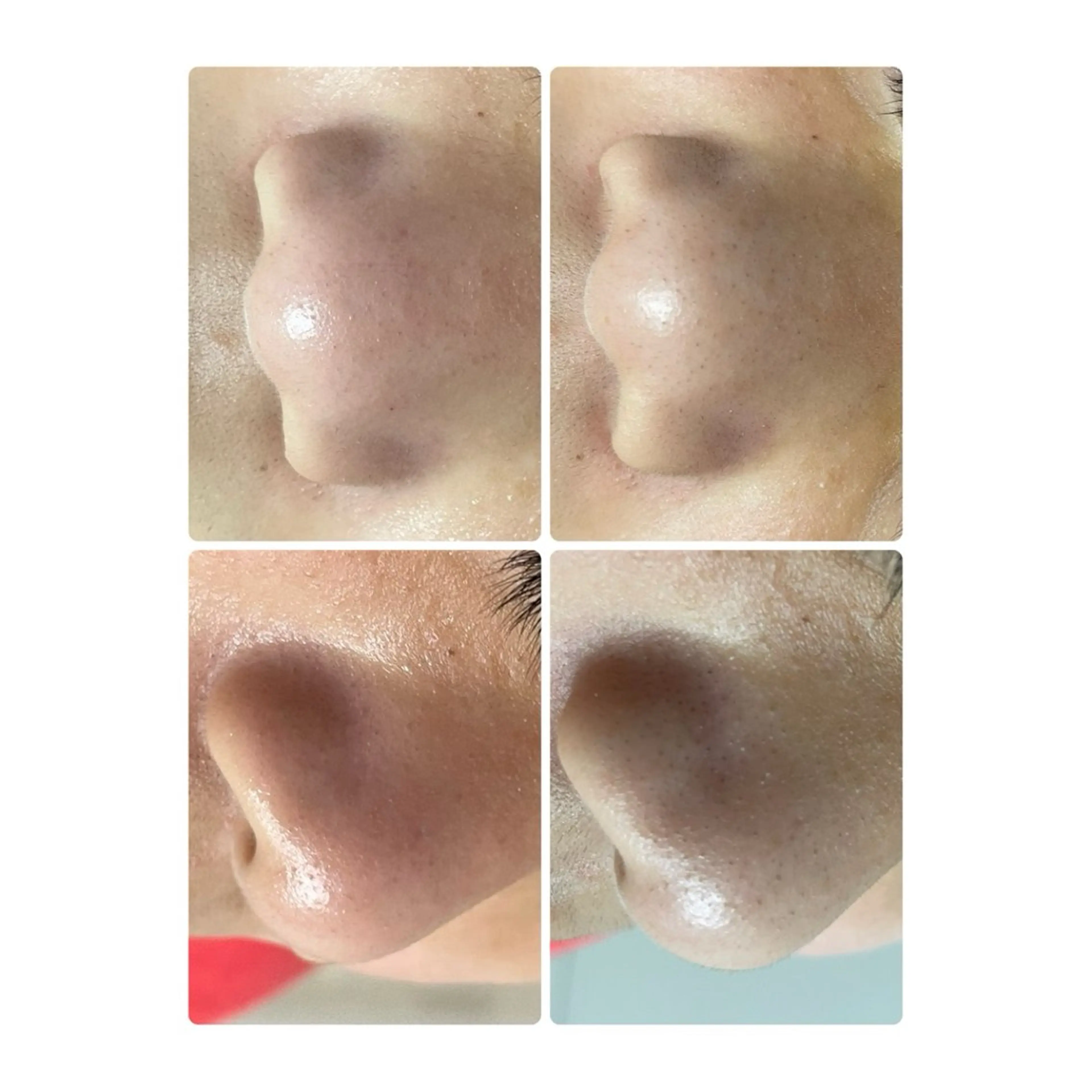 エステ beauty salon  nana所属・beauty salon　nanaのエステ・リラクイメージ