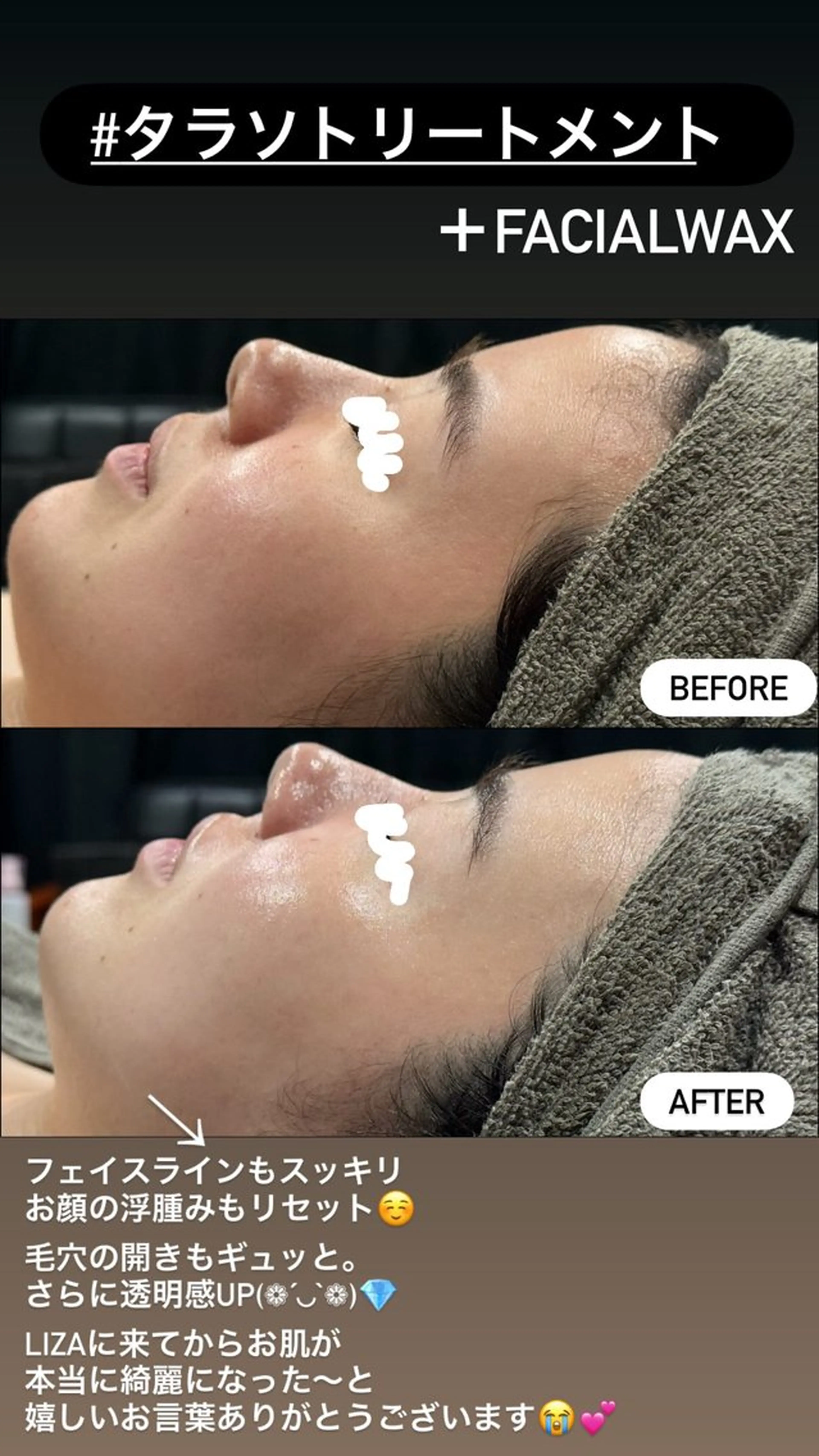 エステ LiZA エステティックサロンのエステ・リラクイメージ