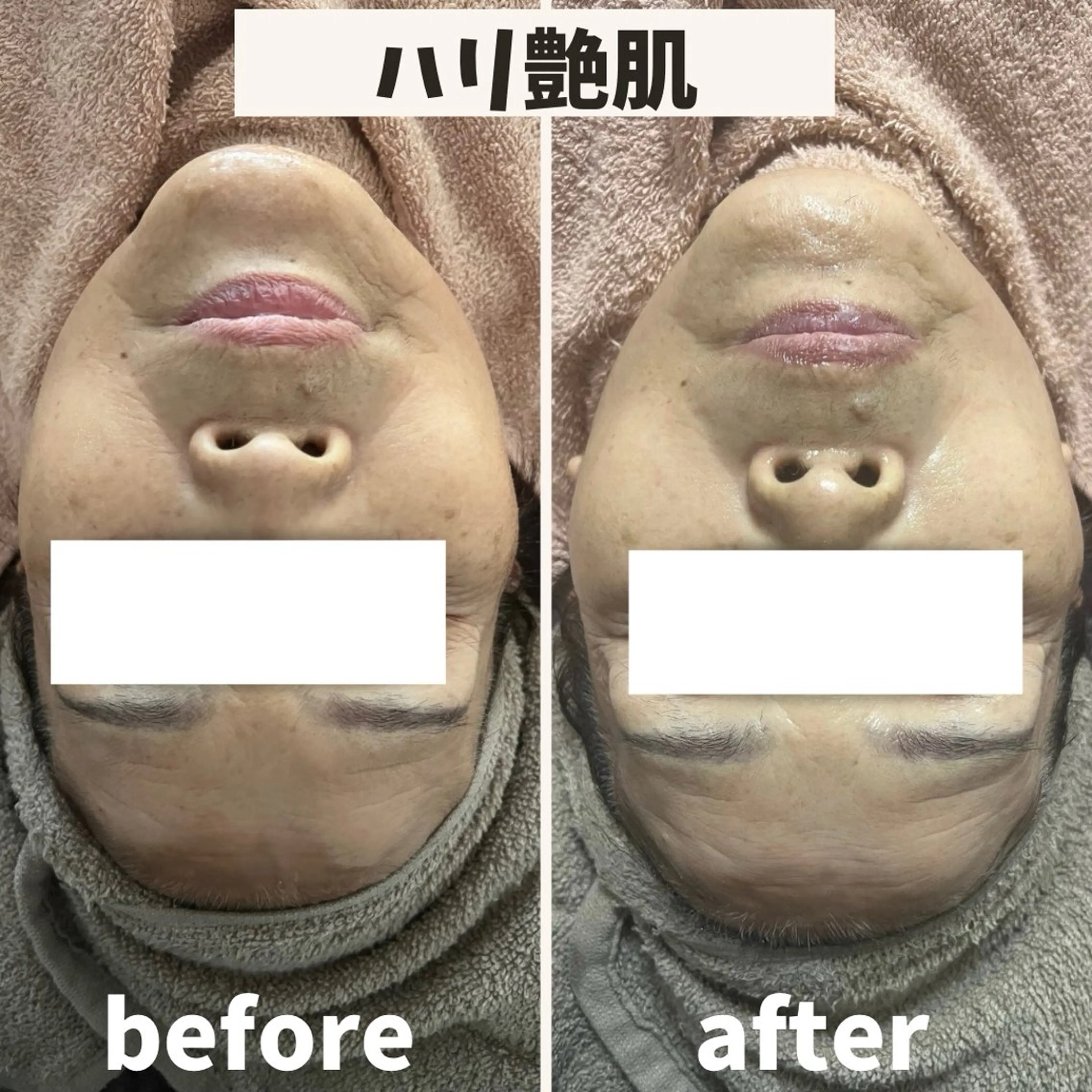 エステ ReN所属・ReN エステサロンのエステ・リラクイメージ