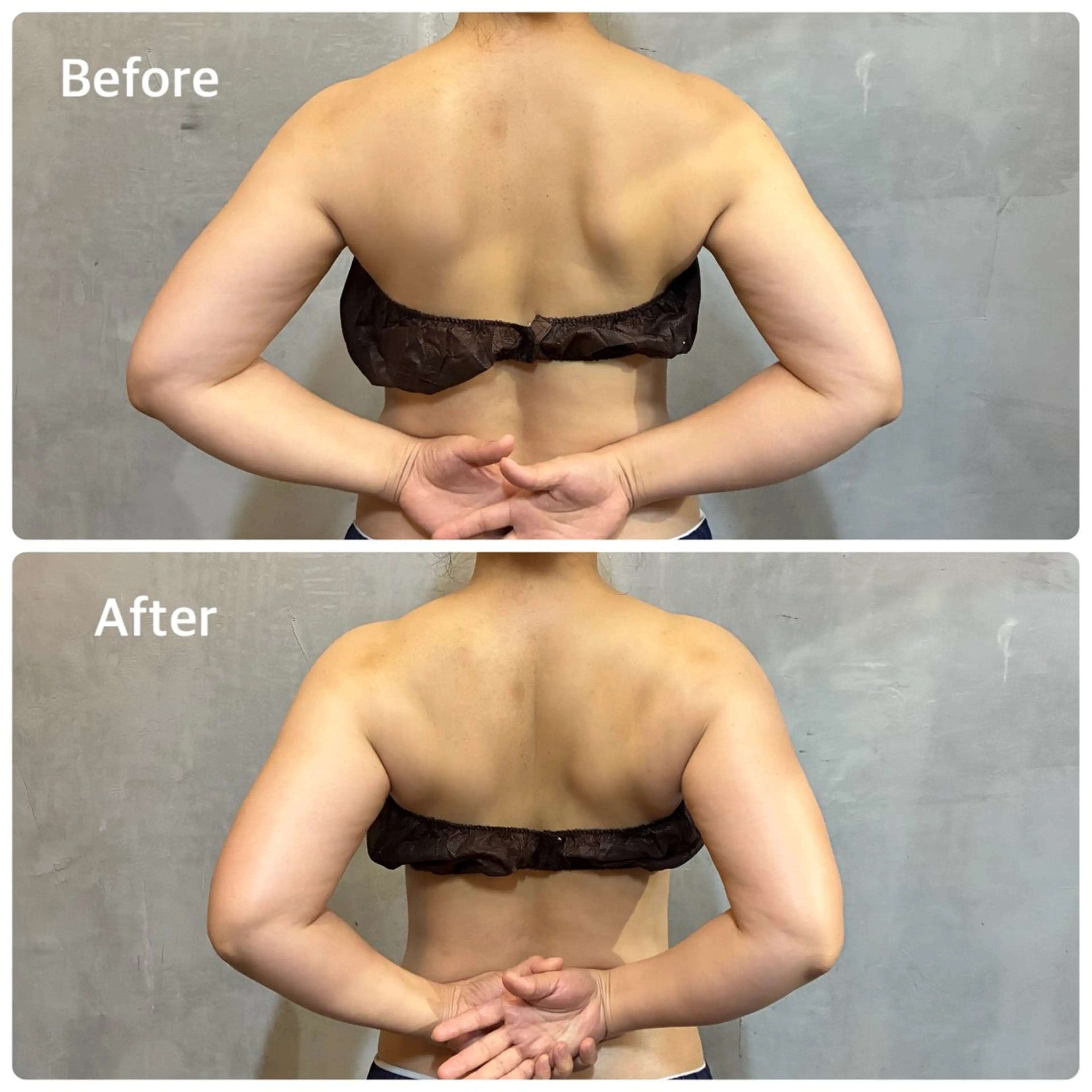 エステ ENABON所属・バストアップサロン ENABON  上野のエステ・リラクイメージ