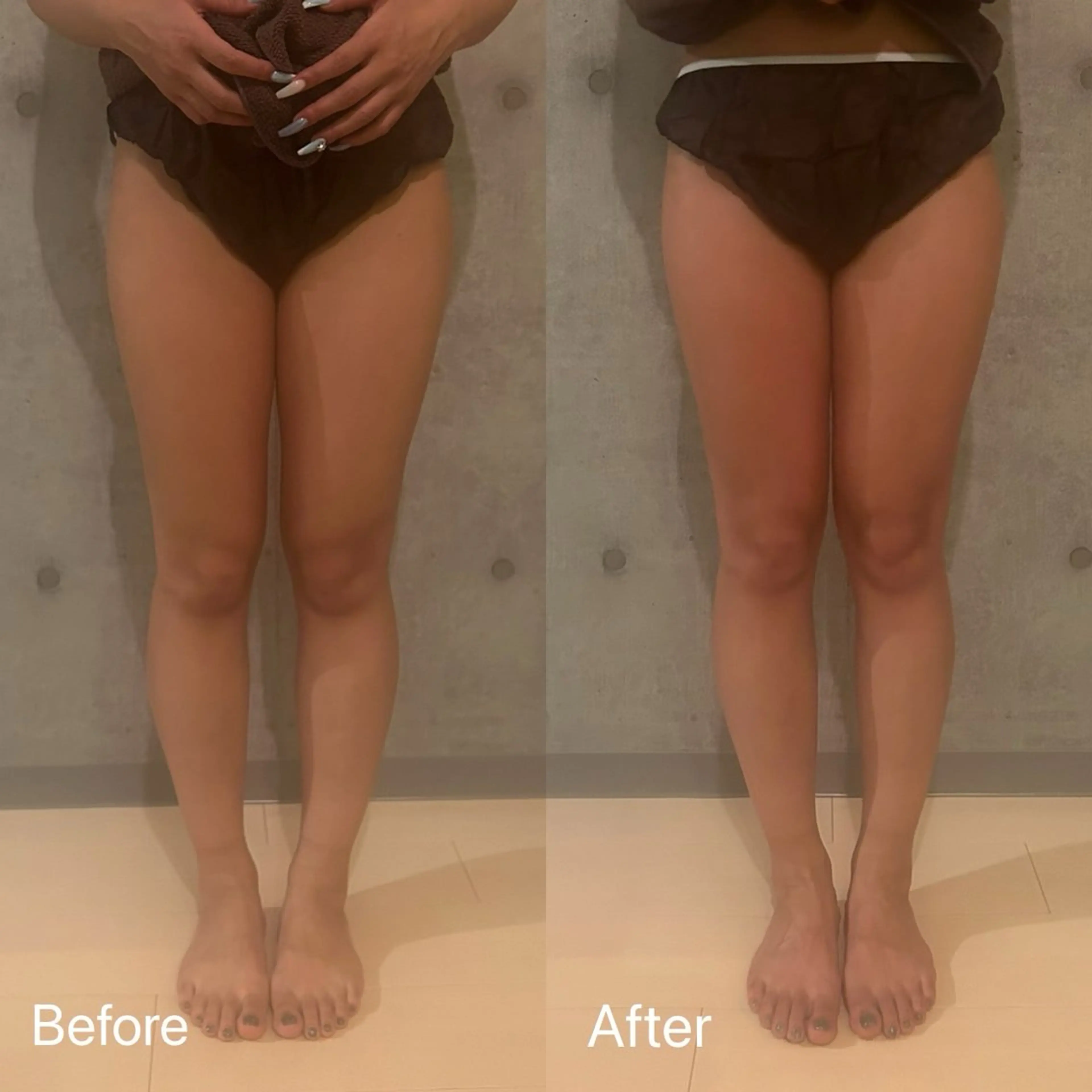 肥後橋INDIBA Salon　Calmのその他イメージ