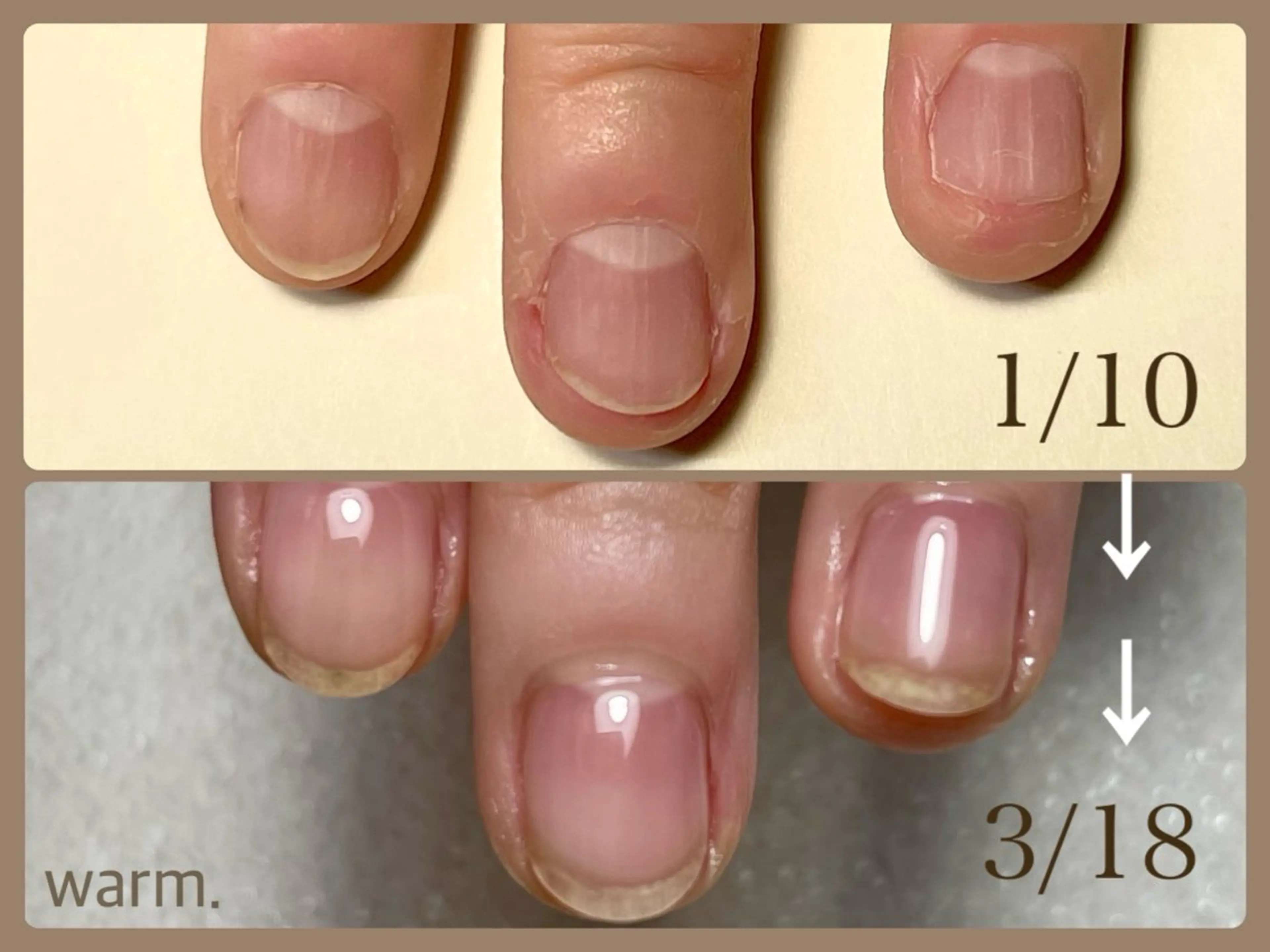 【オフあり】自爪育成クリアネイル：自爪育成ケア込み、フィルイン対応、スカルプ パーツオフ別途220円の写真