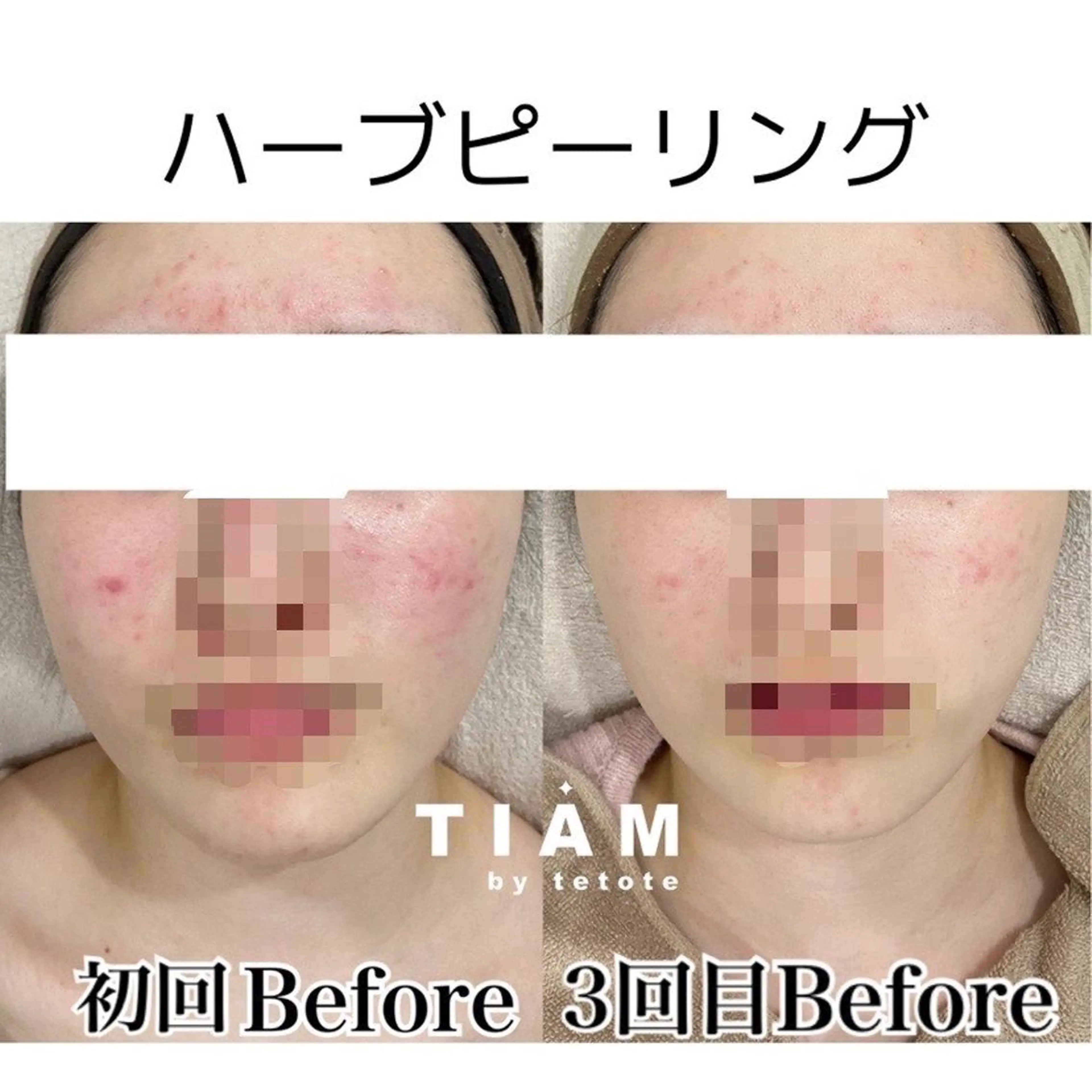 エステ 美肌サロンTIAM by tetoteのエステ・リラクイメージ