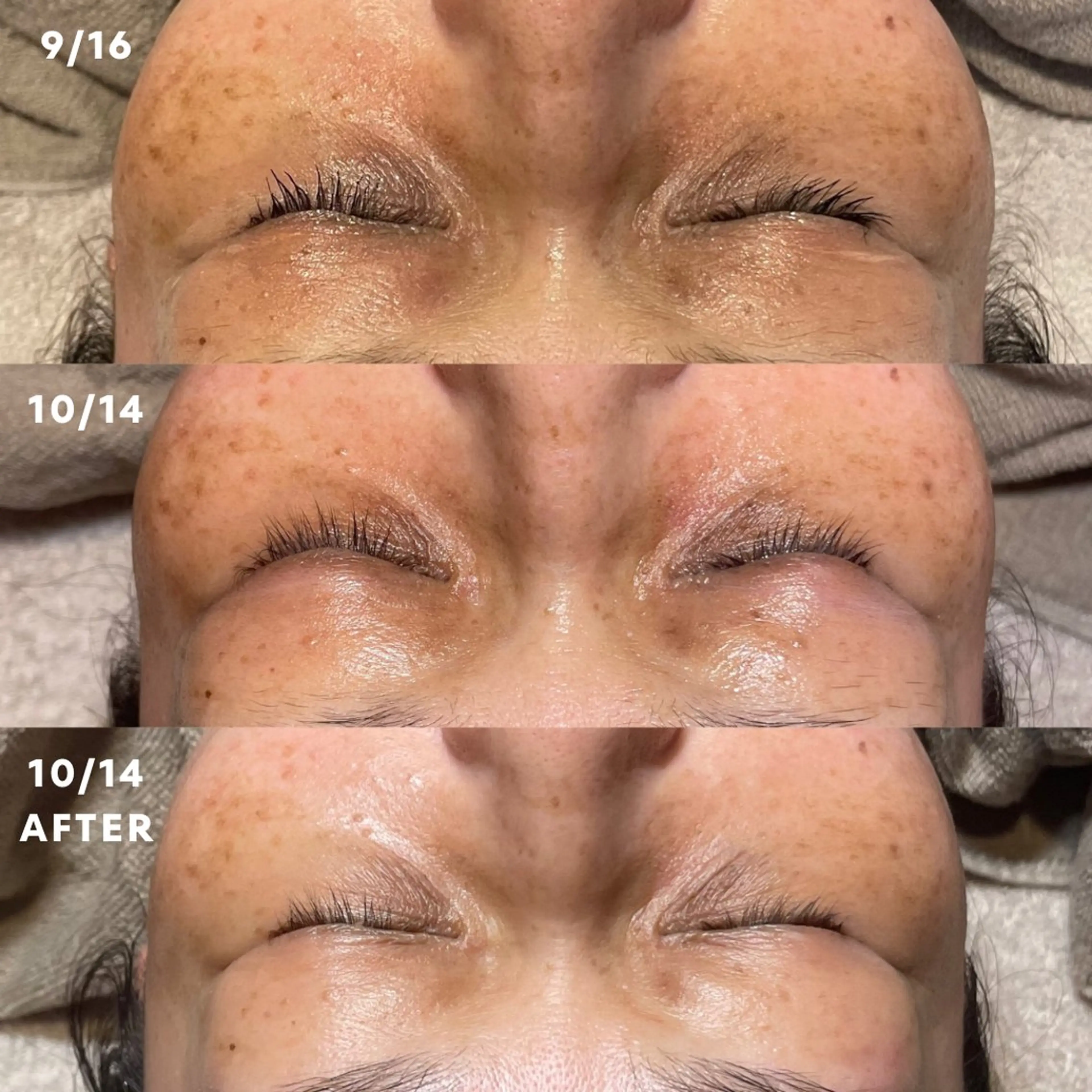 エステ Lassy Yuriの眉毛・アイブロウイメージ