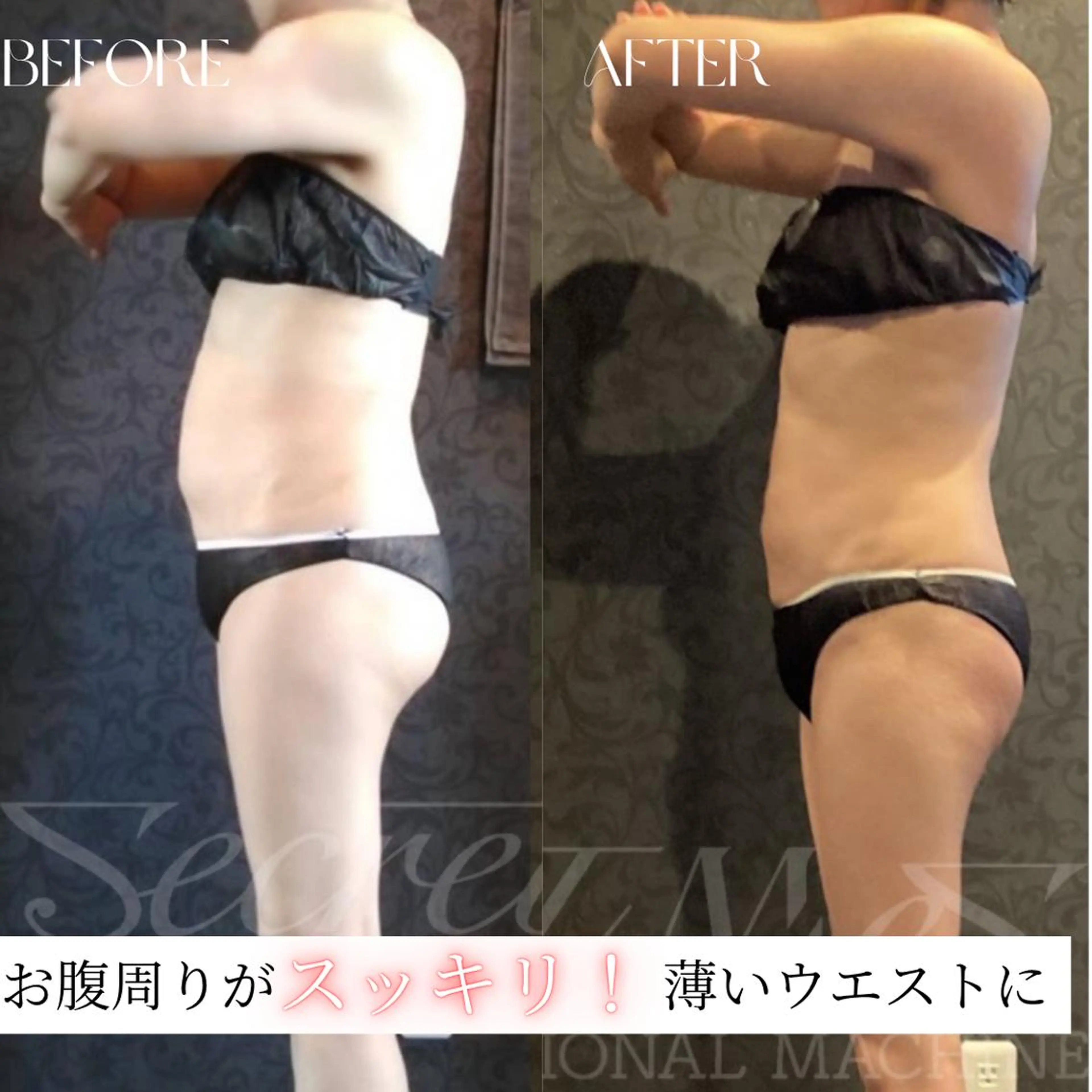 初回体験【セルフ痩身|1部位30分】最先端痩身マシンが当て放題🔥ダイエット/冷えむくみ緩和 ¥3500→¥1100の写真