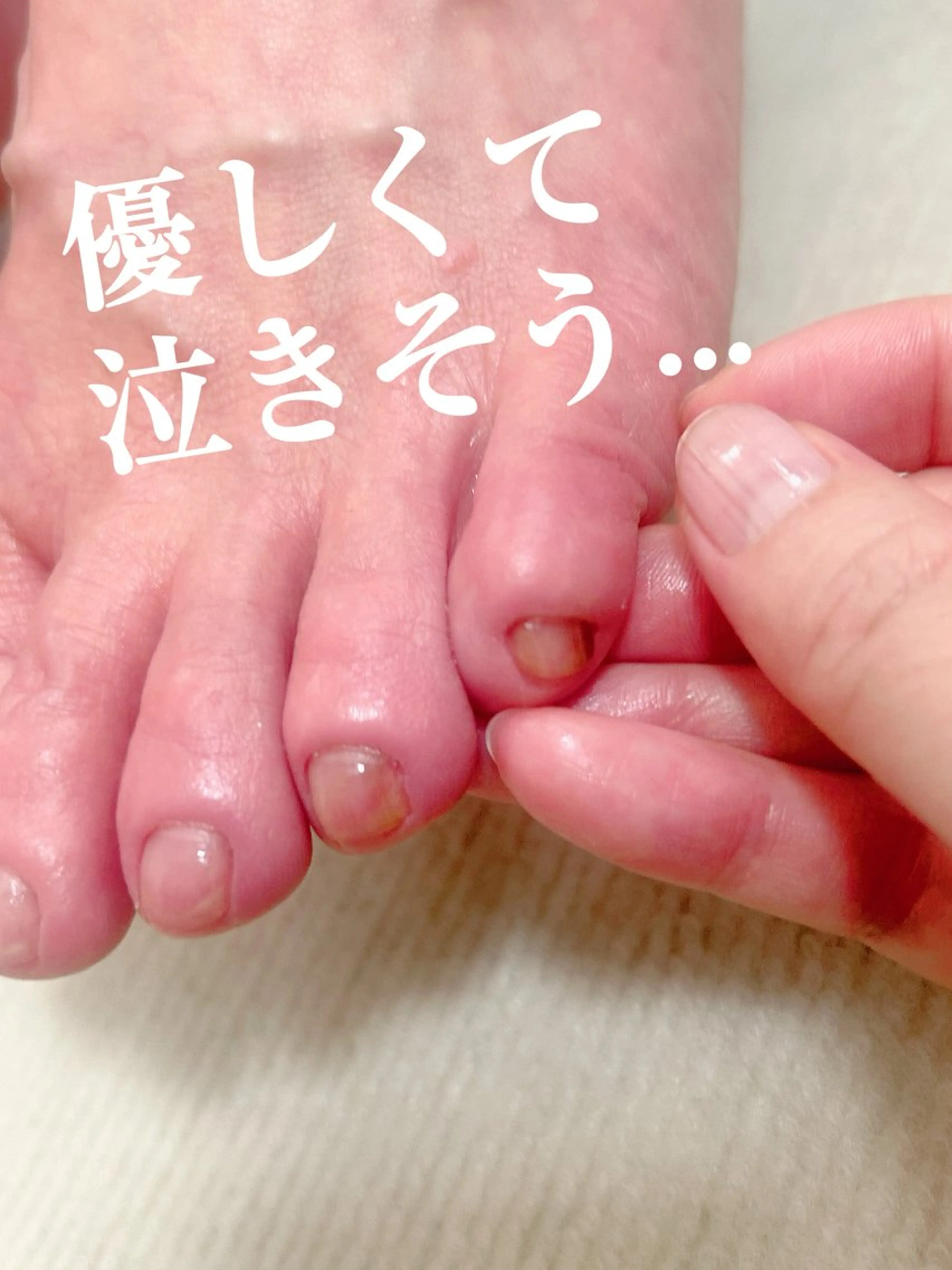 巻き爪フットケアサロンKotori所属・フットケアサロン Kotoriのその他イメージ