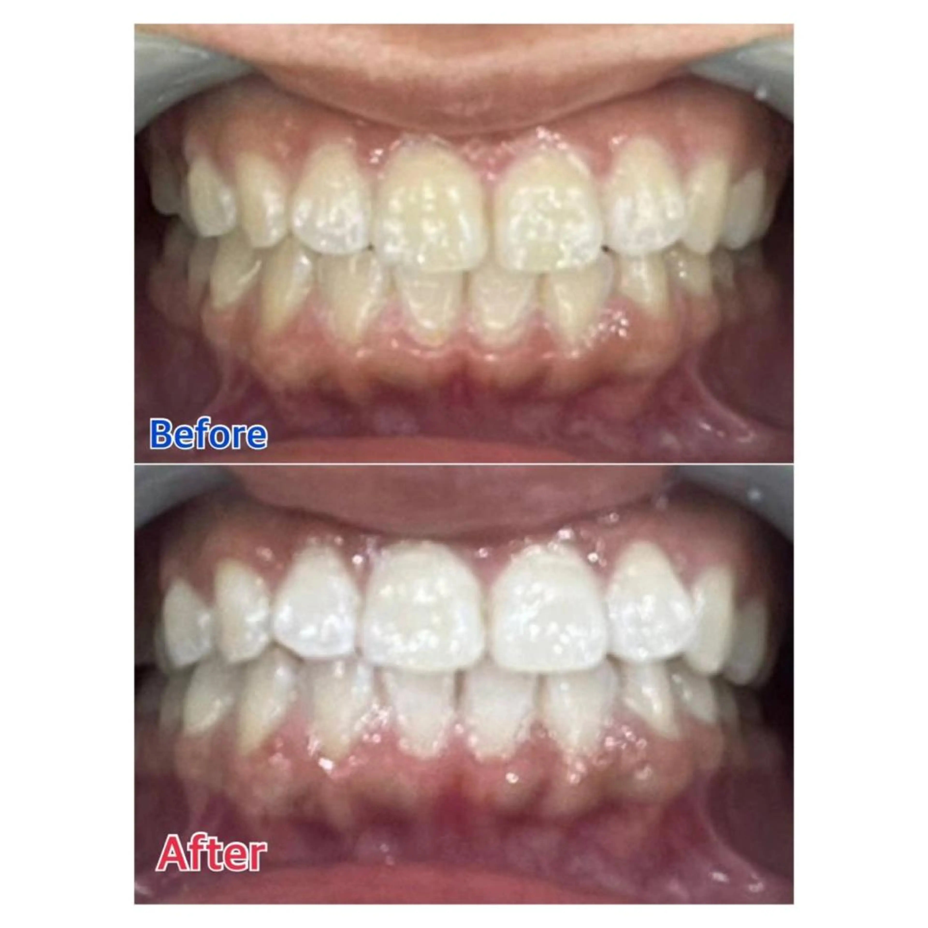 MBEAUTYSALON 千葉店・京成大久保所属・Melty 輝のその他イメージ