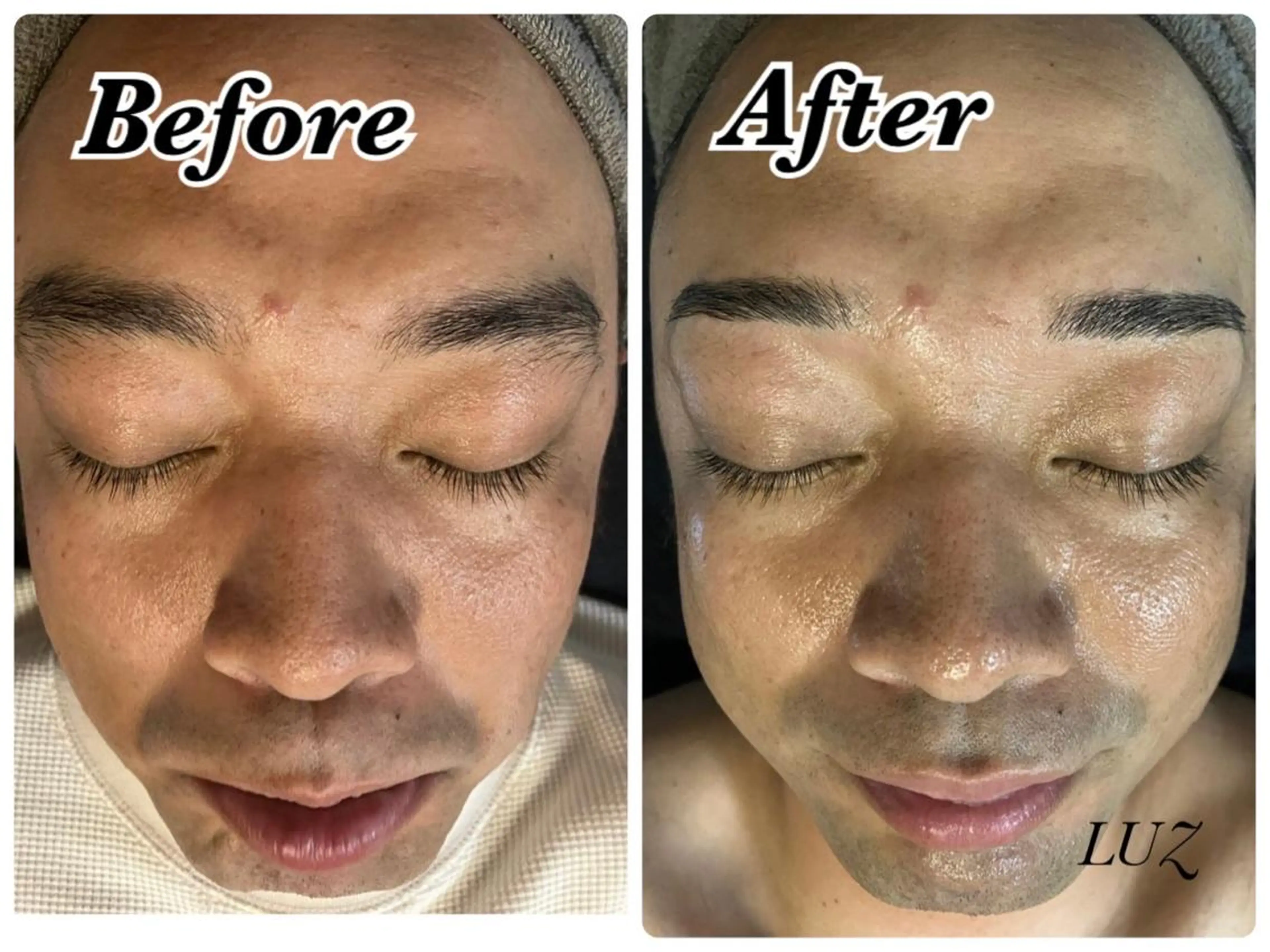 メンズ エステ メンズフェイシャル アイブロウ・ルースのエステ・リラクイメージ