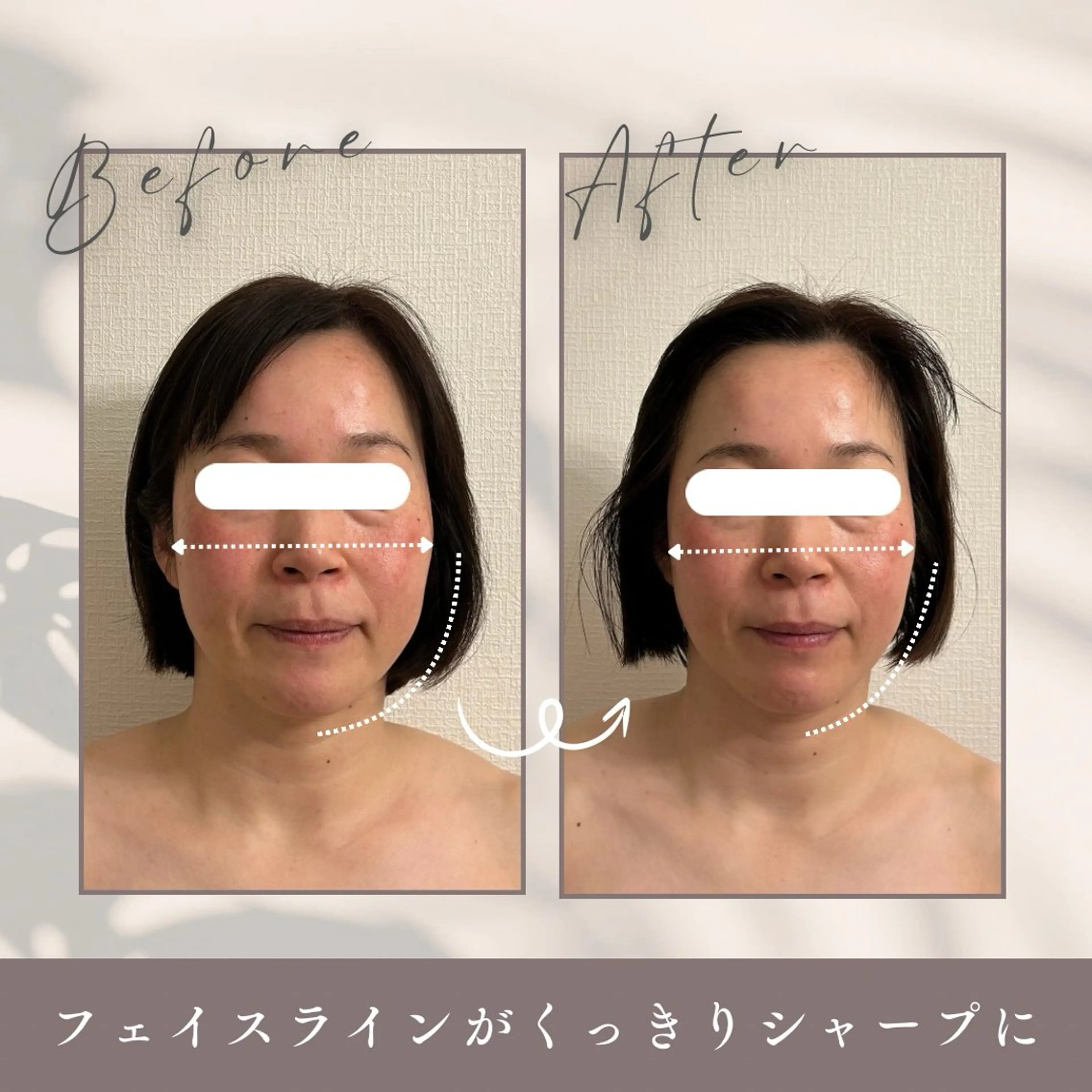 小顔セラピーLIL所属・小顔セラピー LILのエステ・リラクイメージ