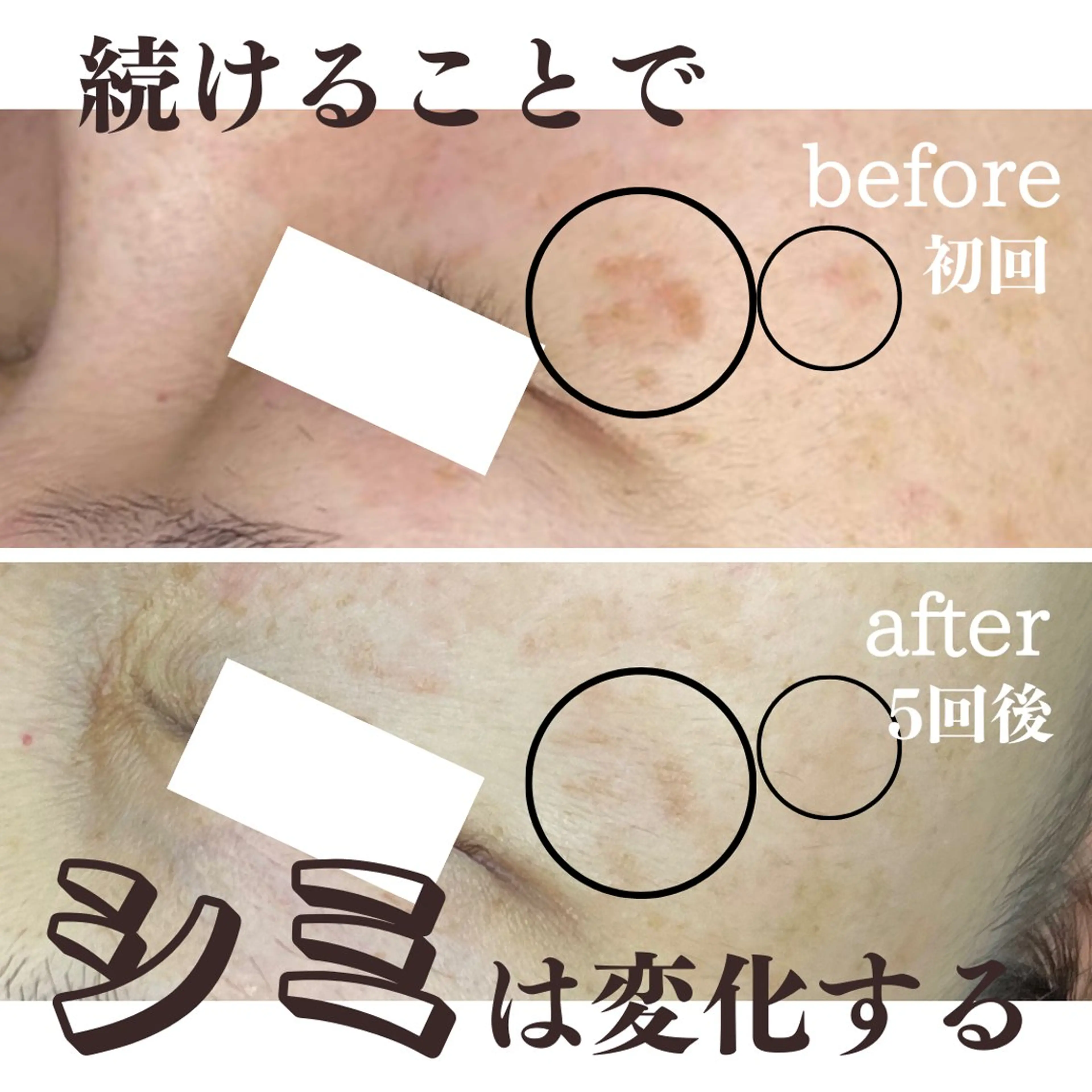 最新シミケアLily de pearlのエステ・リラクイメージ