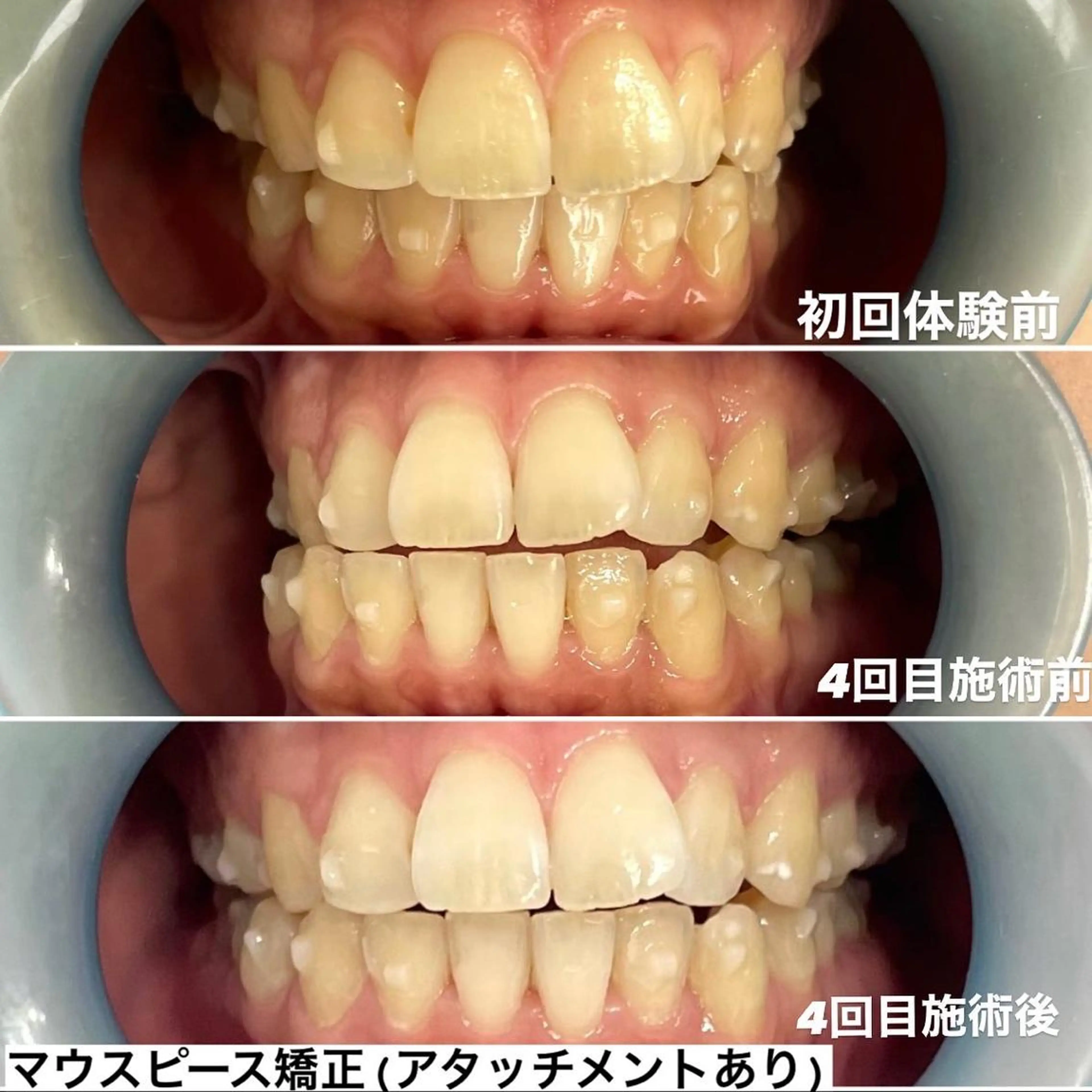 その他 ホワイトニング専門店 Hi-Whiteのその他イメージ