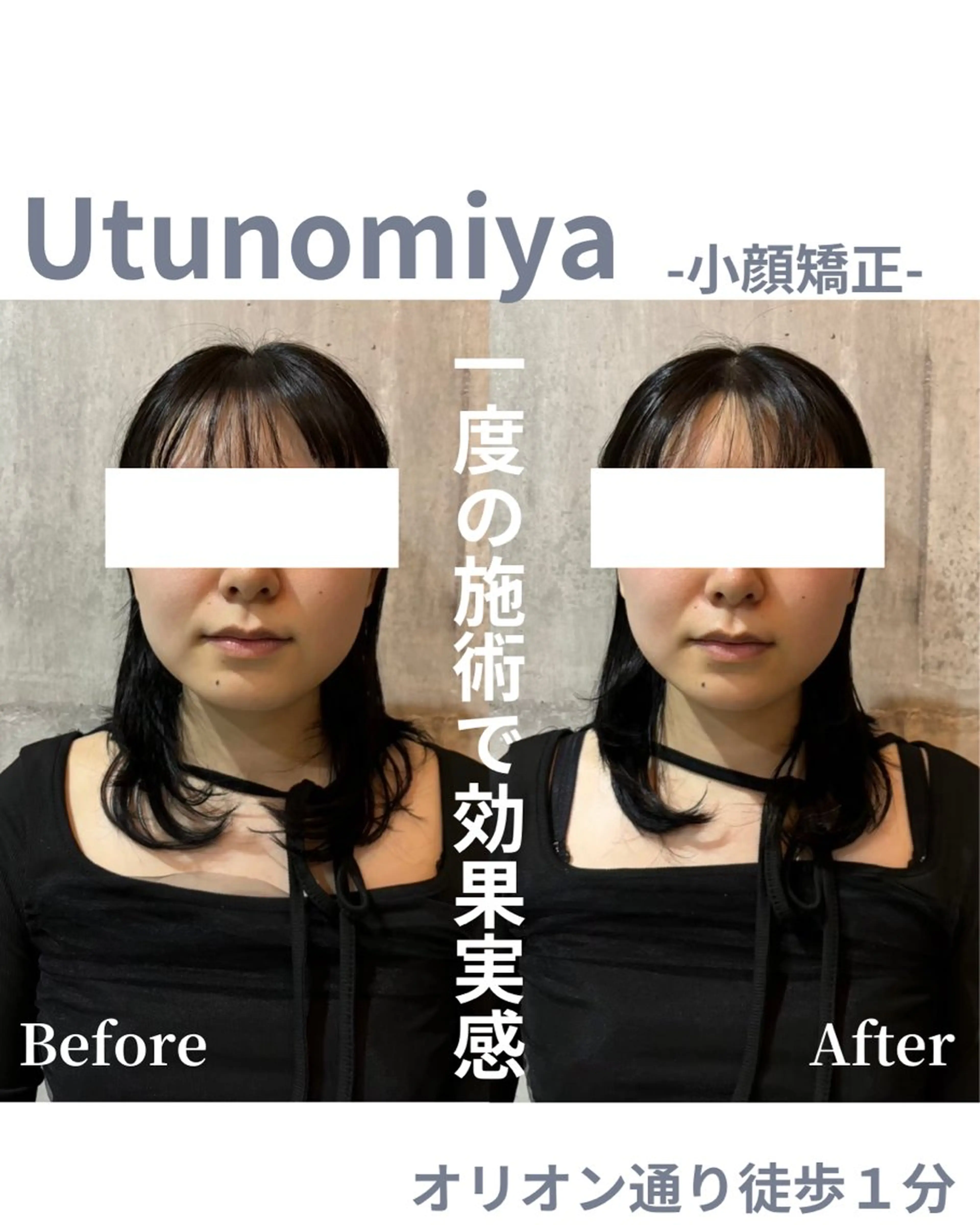 Men's Nail Vitip所属・sekiyama junnaのエステ・リラクイメージ