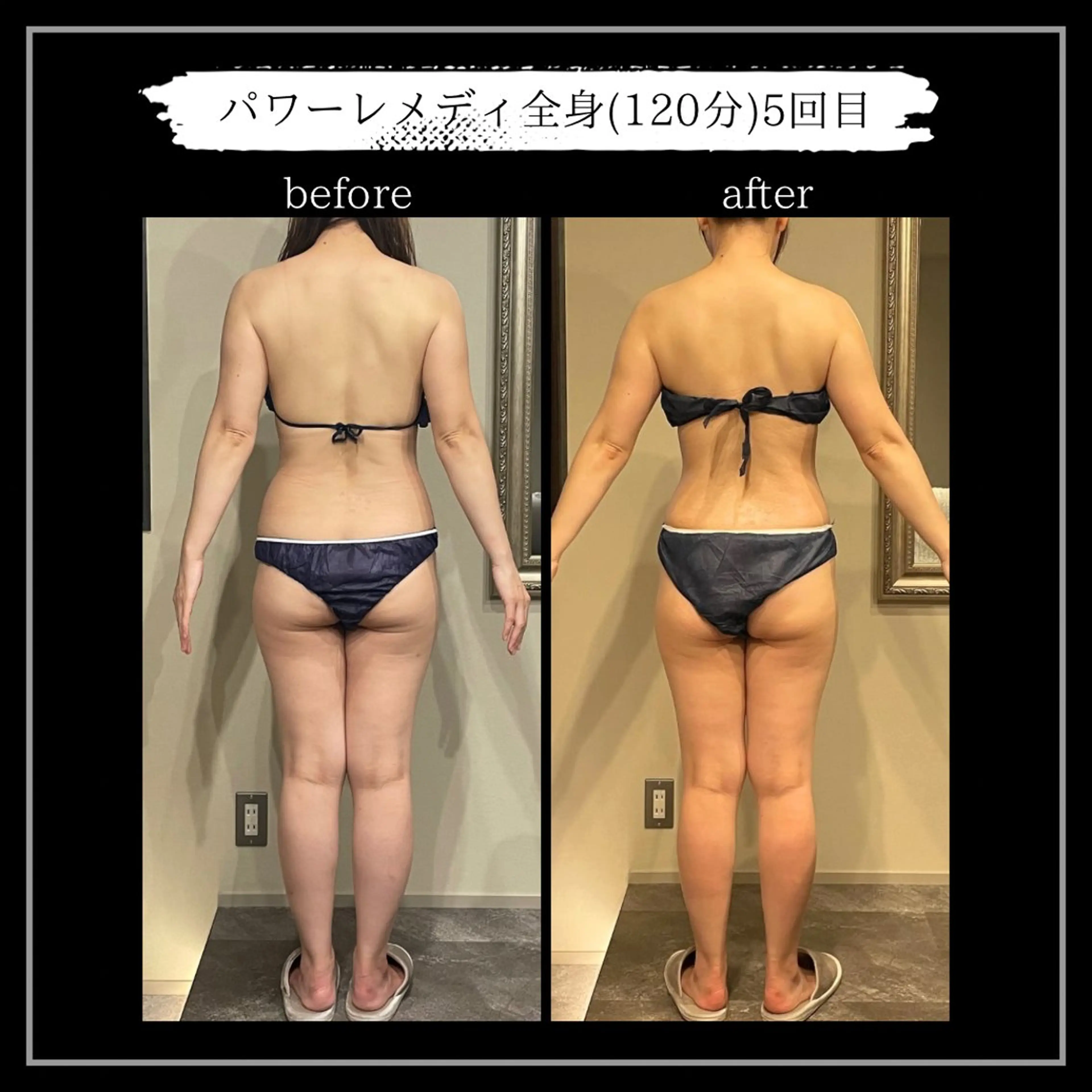 オフ:オン所属・オフ:オン 全身筋膜マッサージのエステ・リラクイメージ